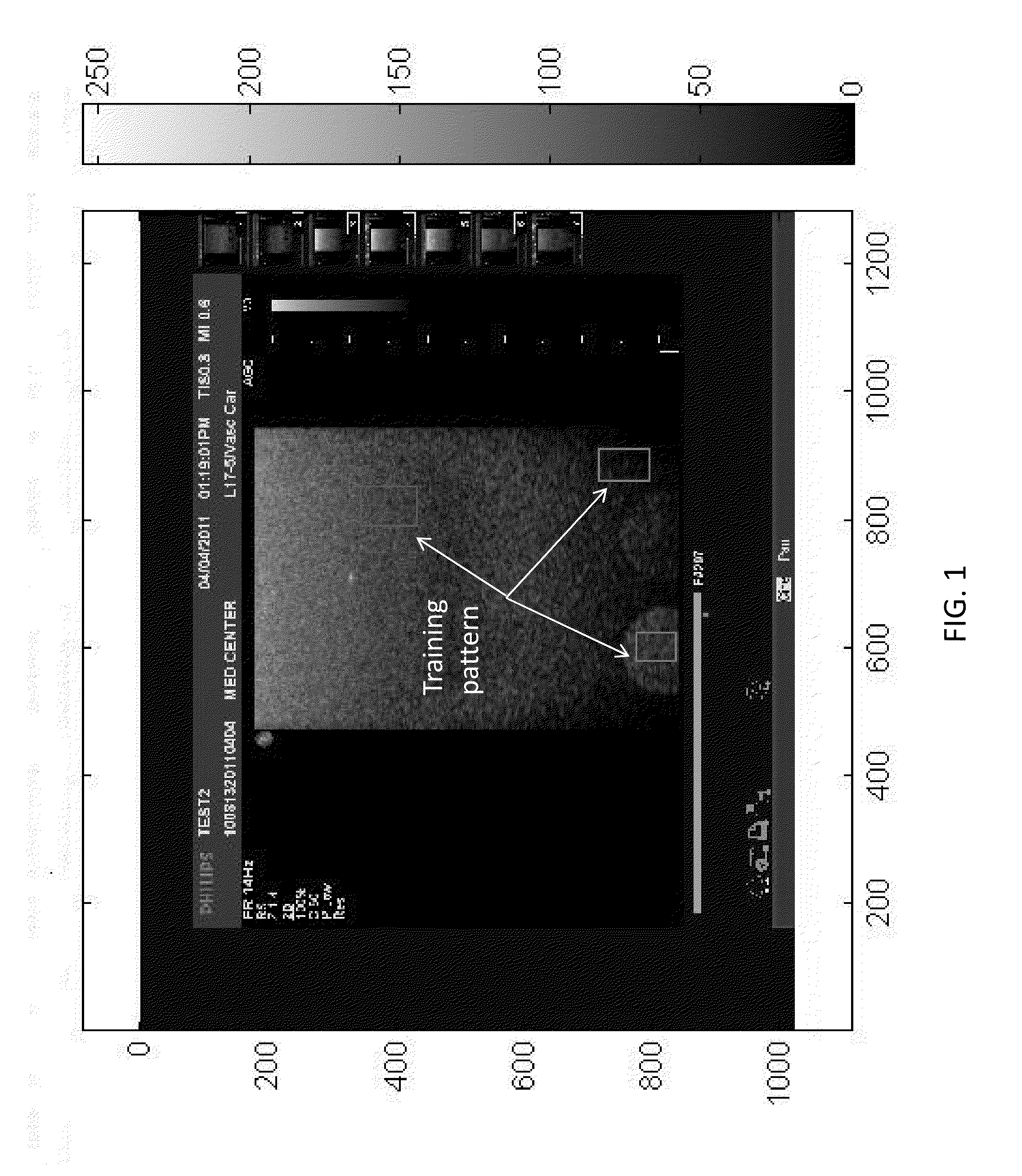 Method and system of characterization of carotid plaque