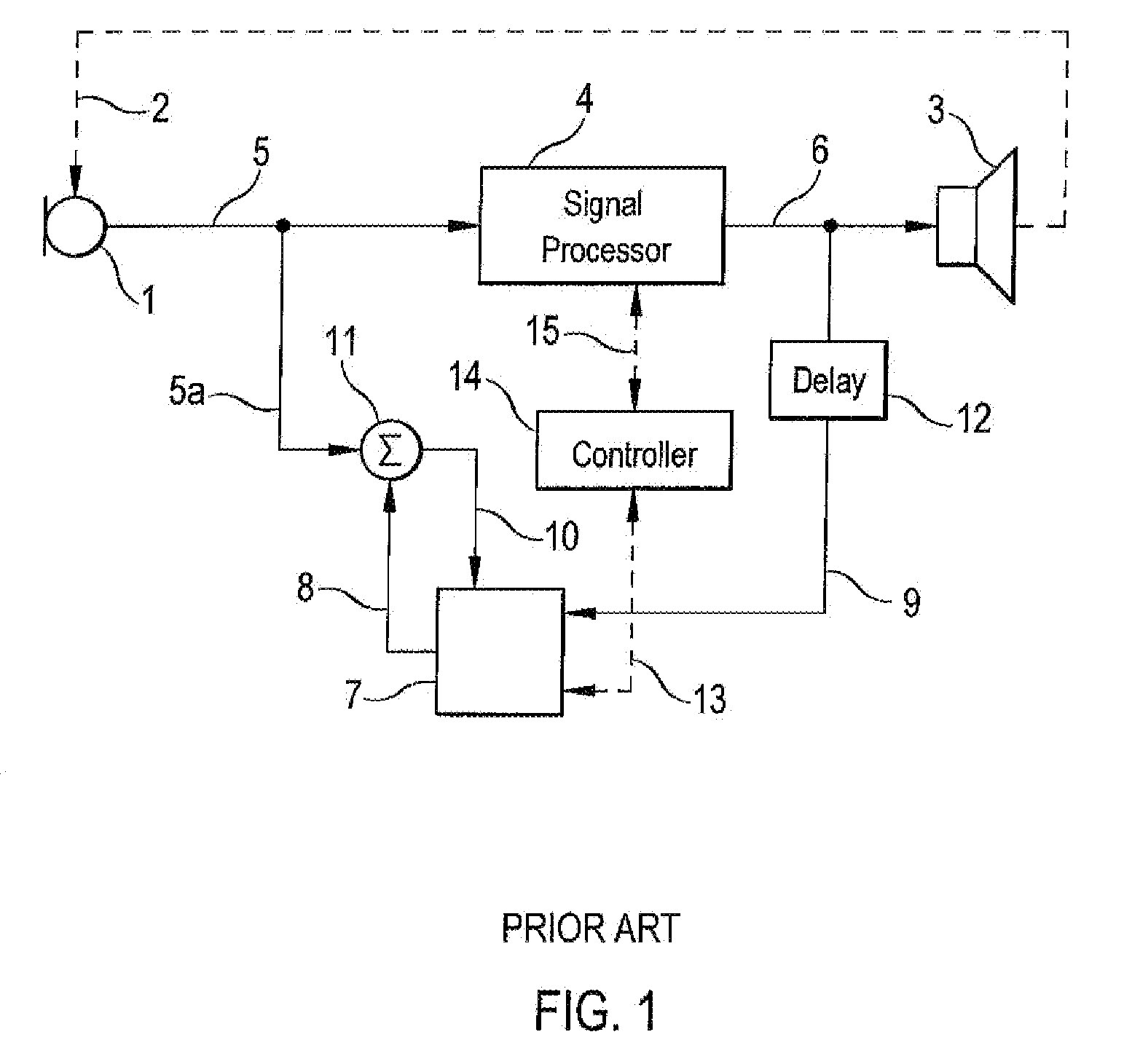 Hearing aid and method of estimating dynamic gain limitation in a hearing aid