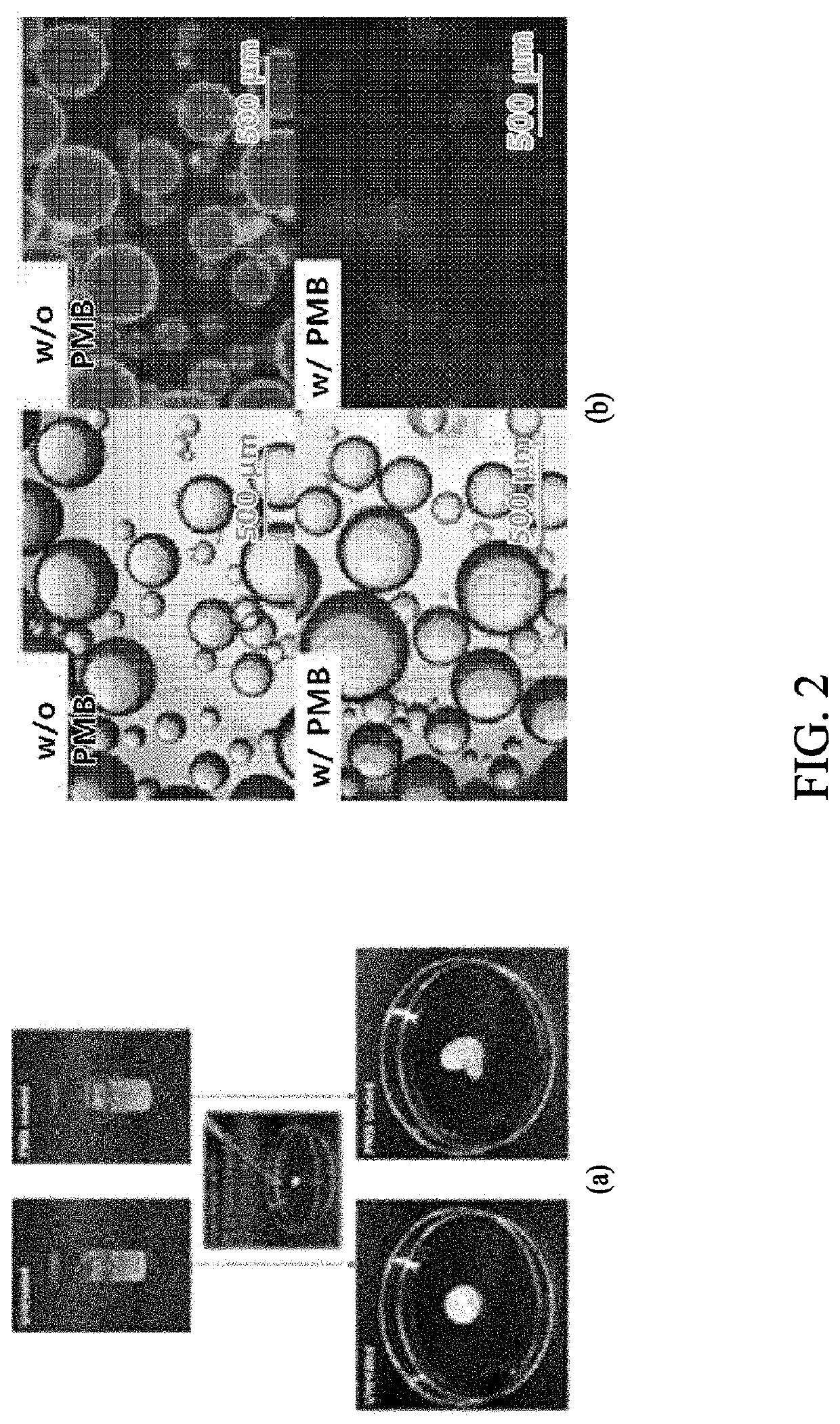 In vivo bulking agent, injection comprising same, and preparation method therefor