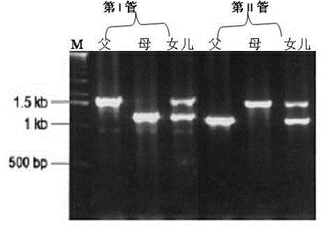 Primers, method and kit for detecting inversion of first intron of hemophilia A clotting factor VIII gene