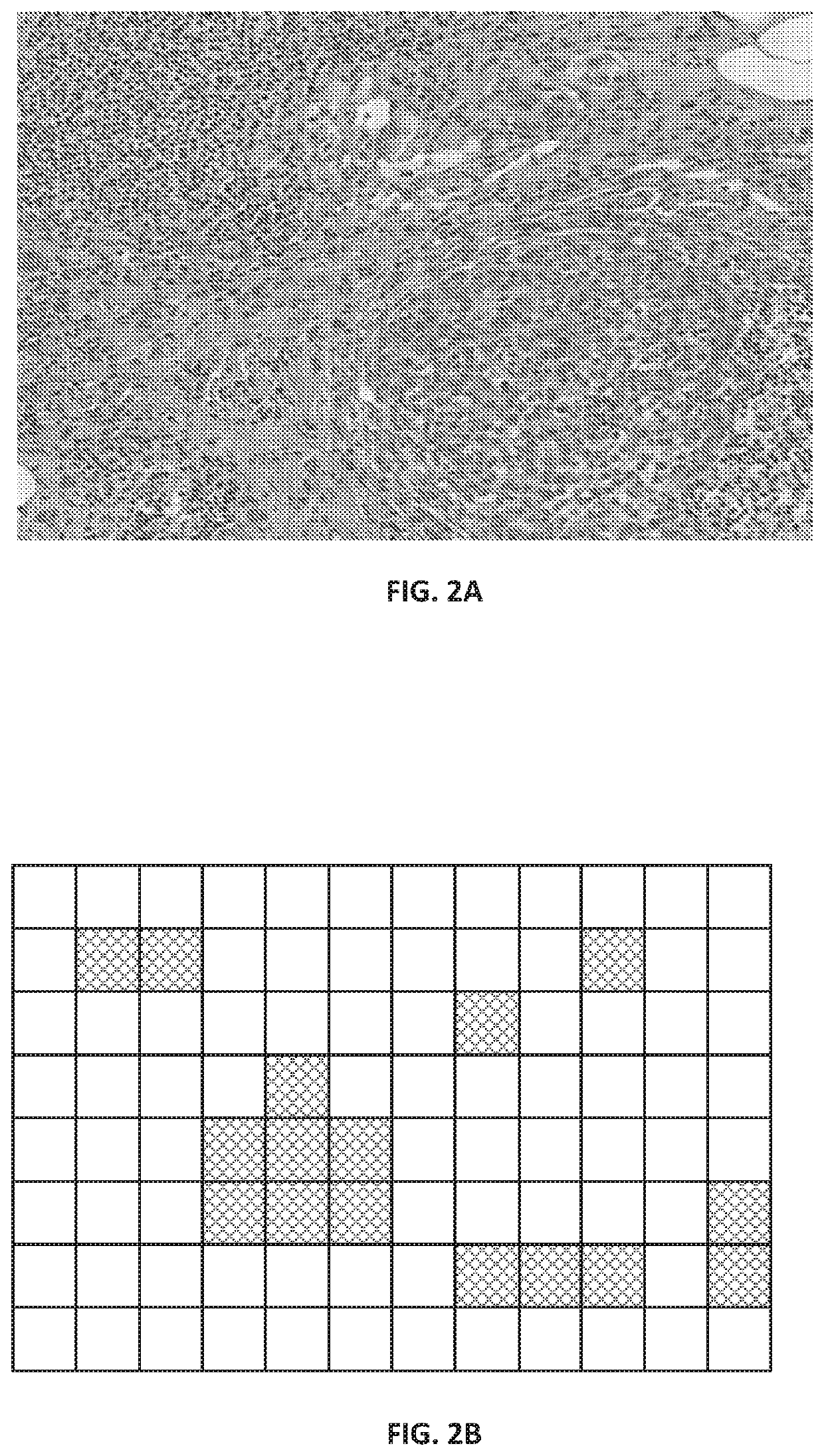 Neural netork based identification of areas of interest in digital pathology images