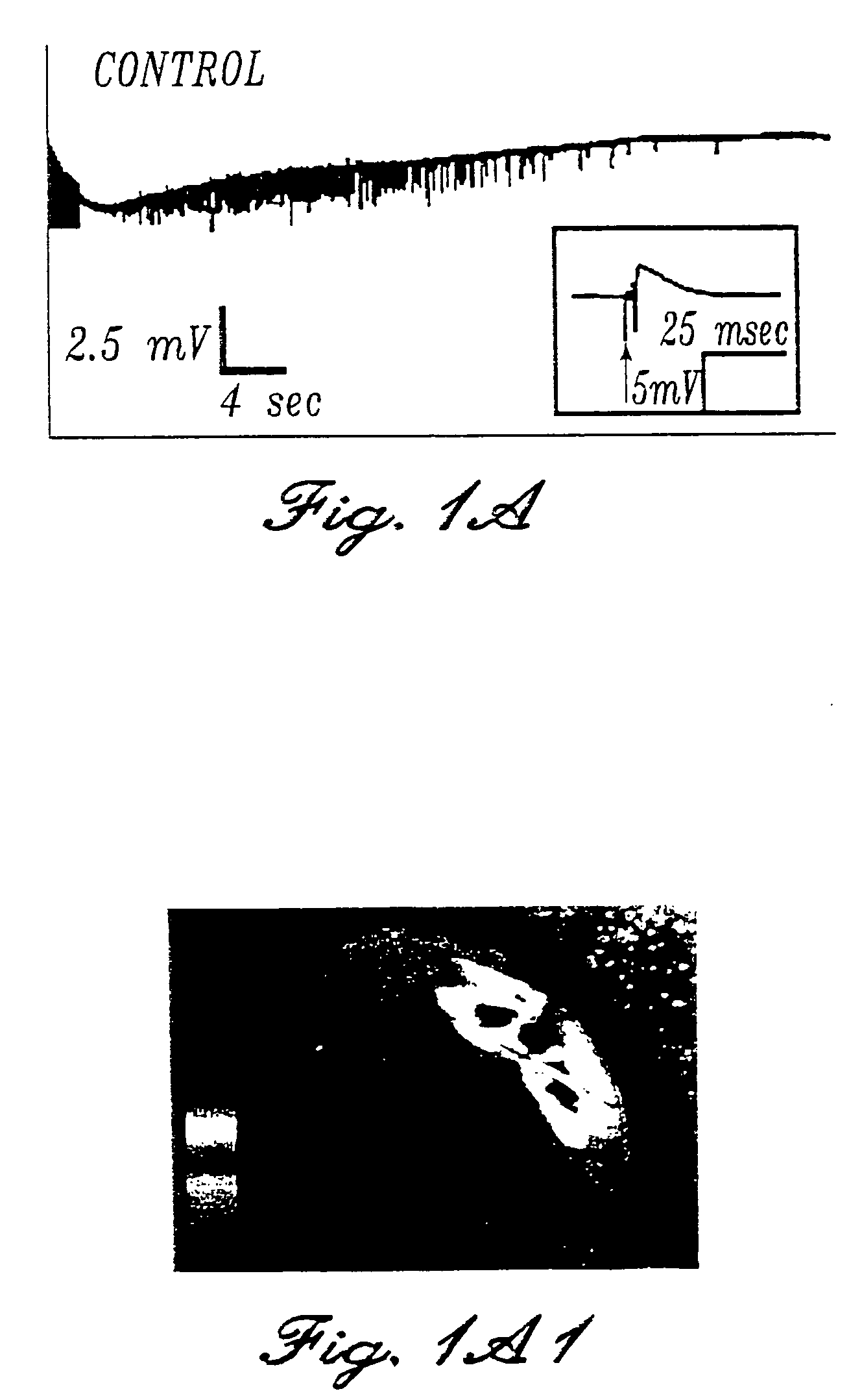 Methods and compositions for the treatment of neuropathic pain and neuropsychiatric disorders