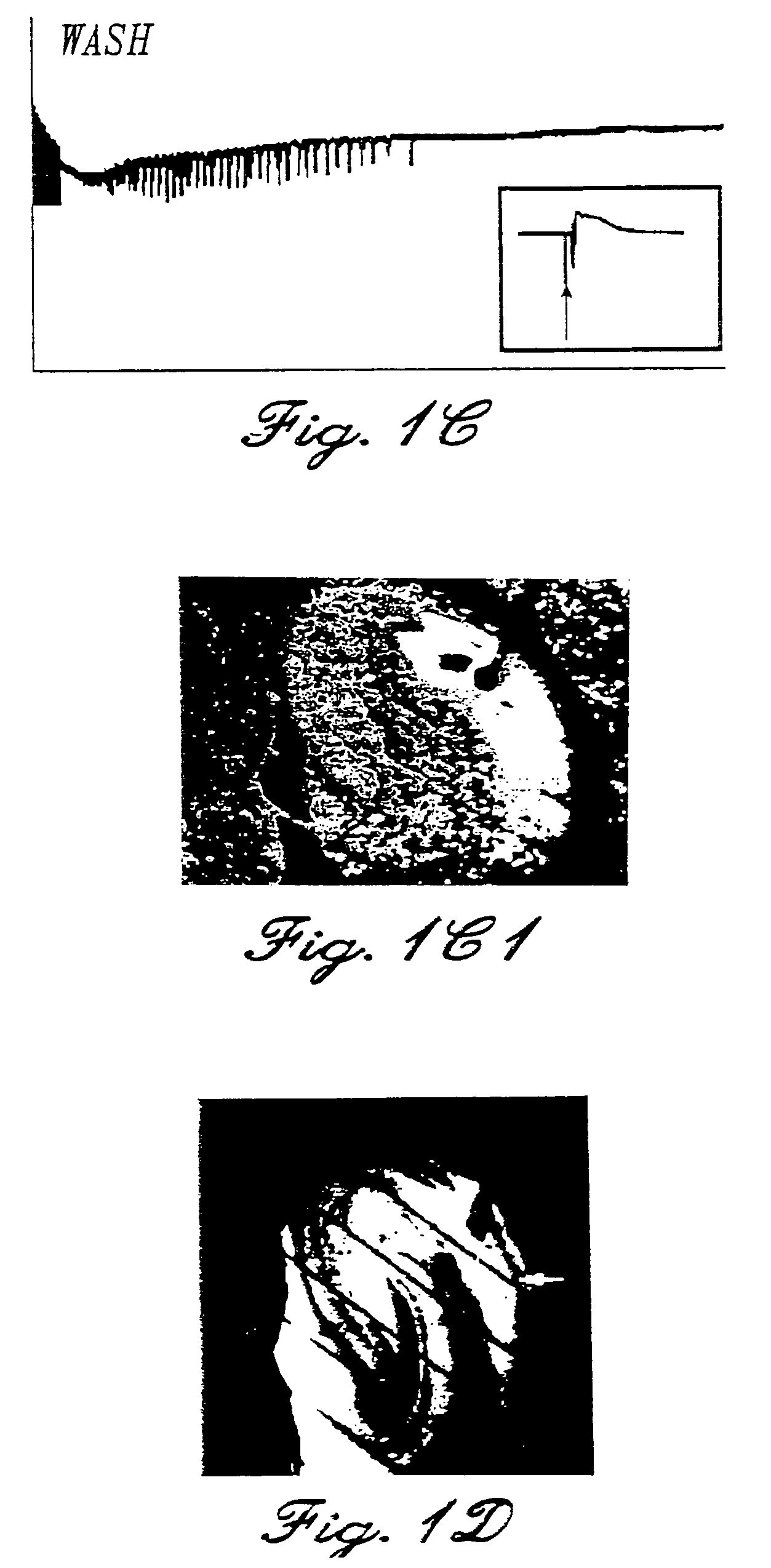 Methods and compositions for the treatment of neuropathic pain and neuropsychiatric disorders