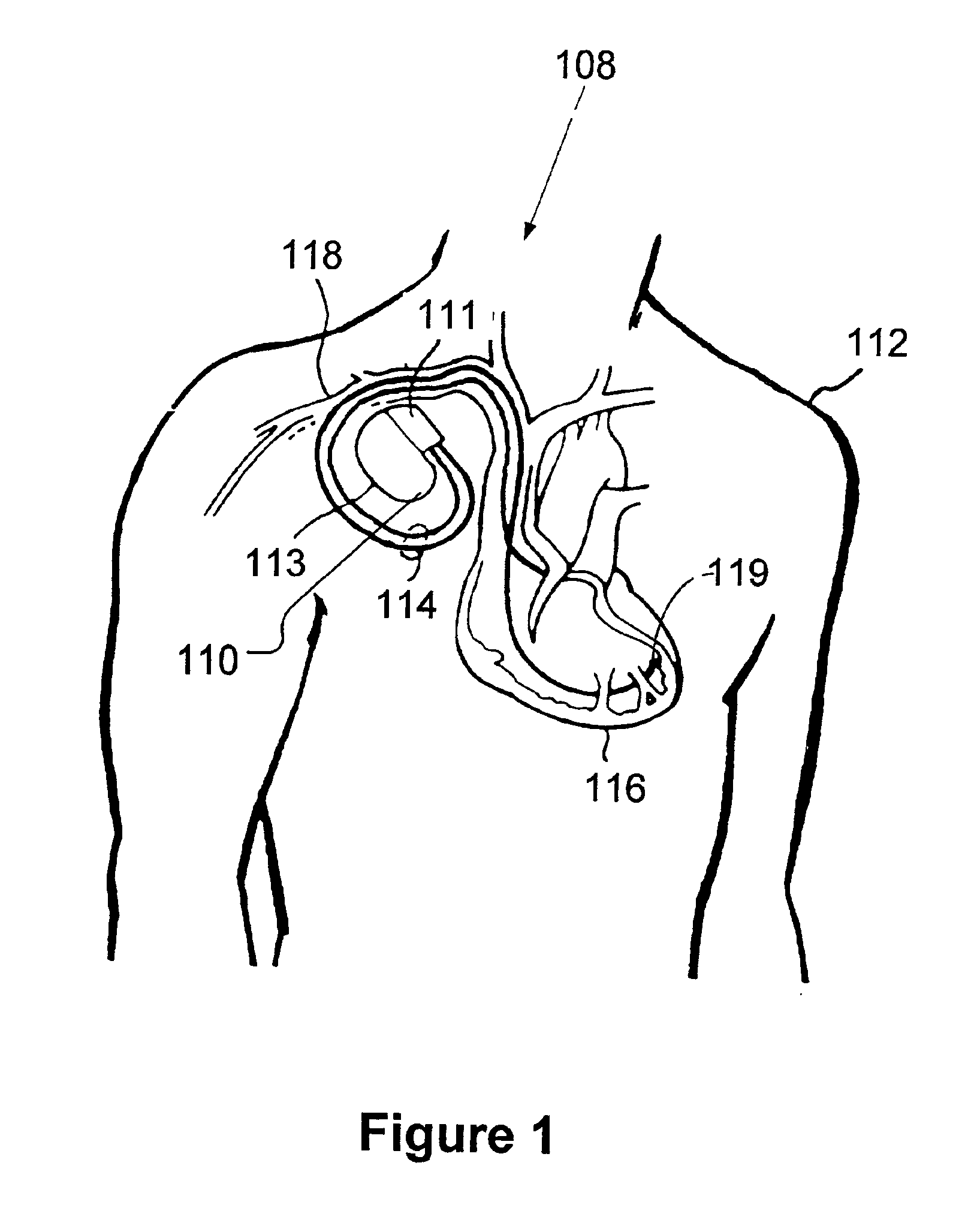 Method and apparatus for detecting static magnetic fields