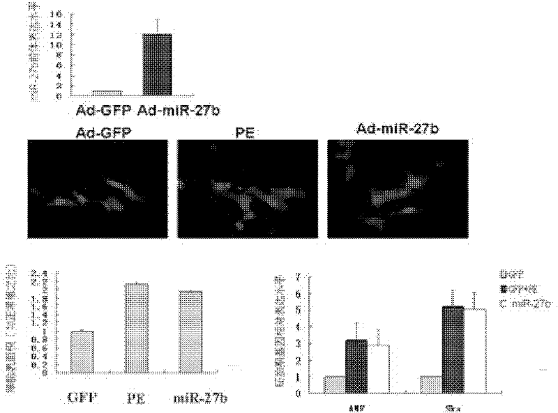 Composition for inhibition of expression of miR-27b, medicines containing the same, and use for the same