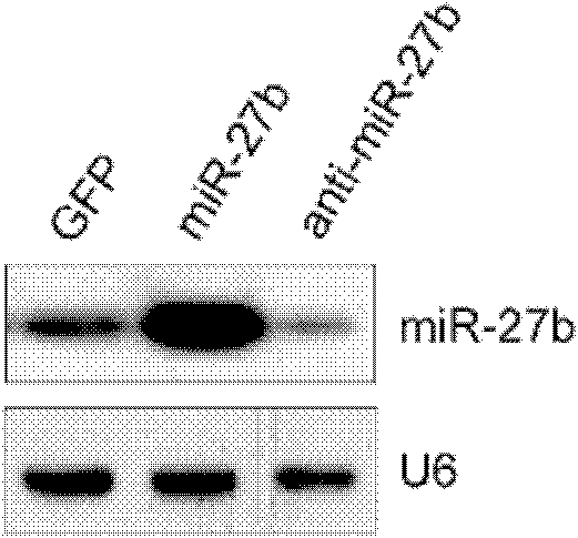 Composition for inhibition of expression of miR-27b, medicines containing the same, and use for the same