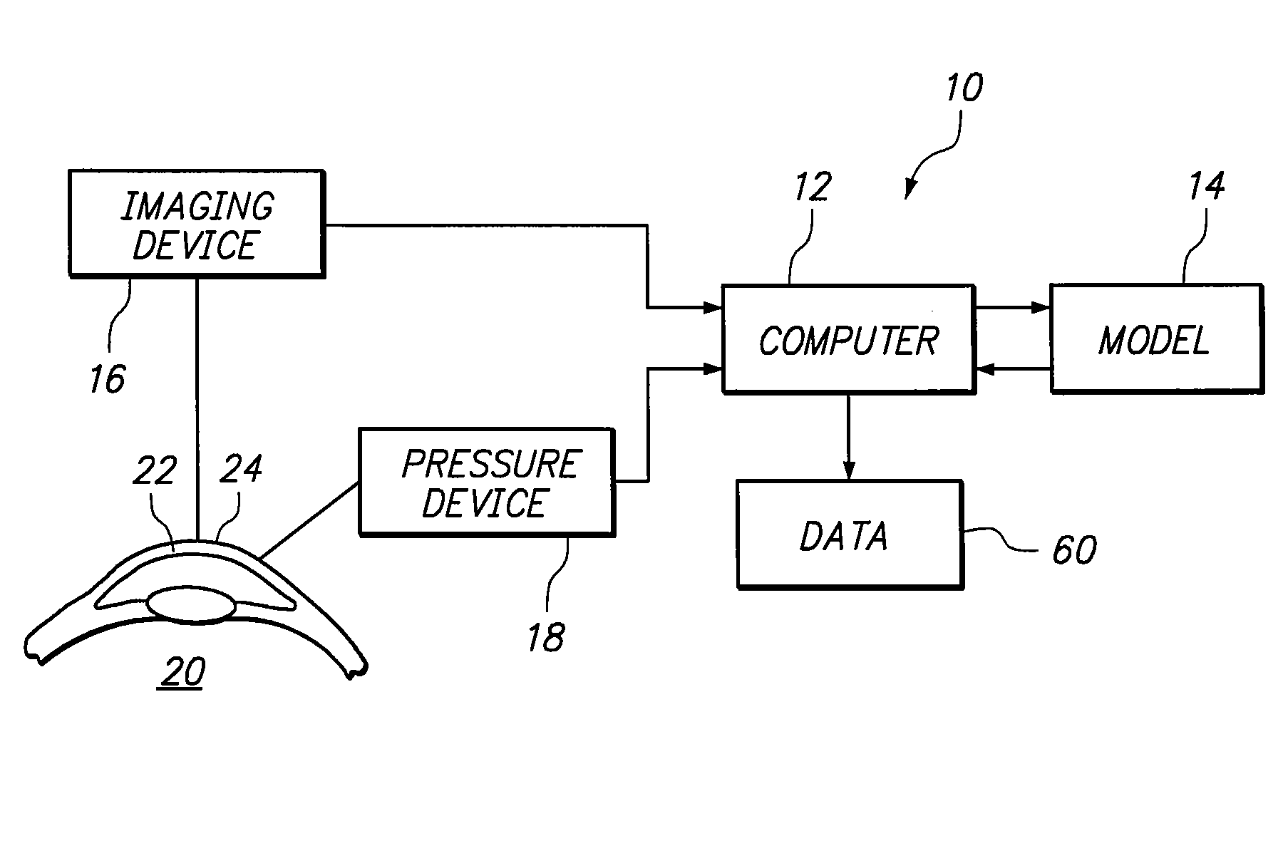 Finite element model of a keratoconic cornea