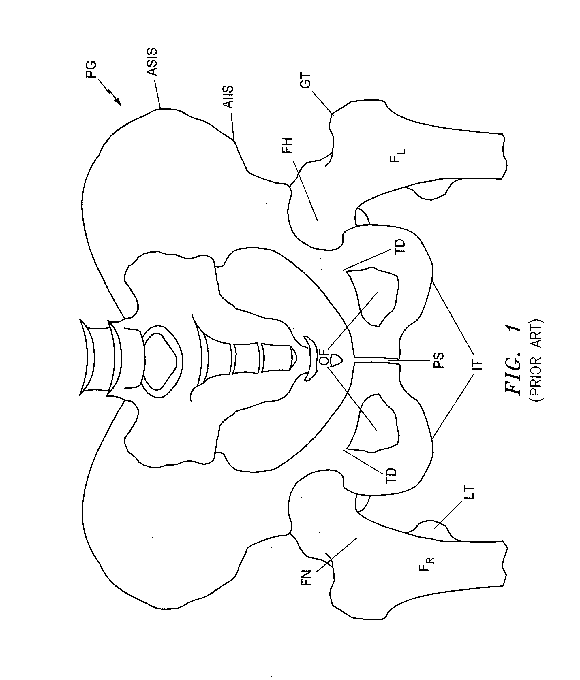 Systems and Methods for Intra-Operative Image Analysis