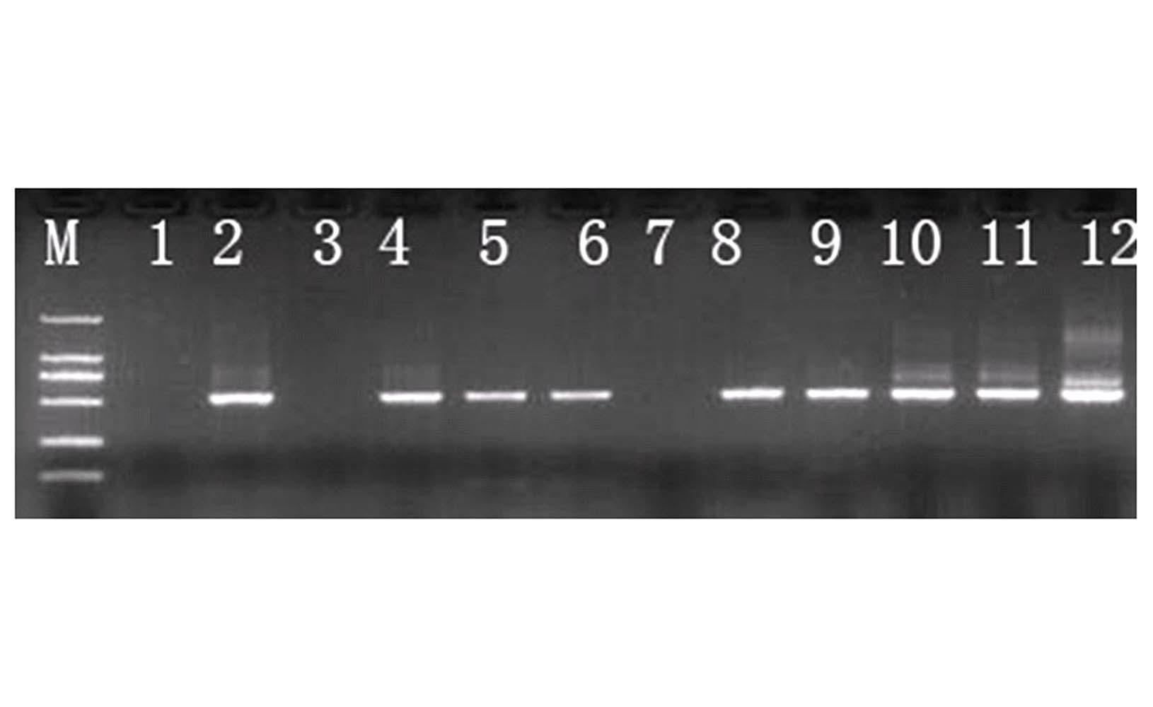 Sugarcane smut bacteria nest type polymerase chain reaction (PCR) quick detection method