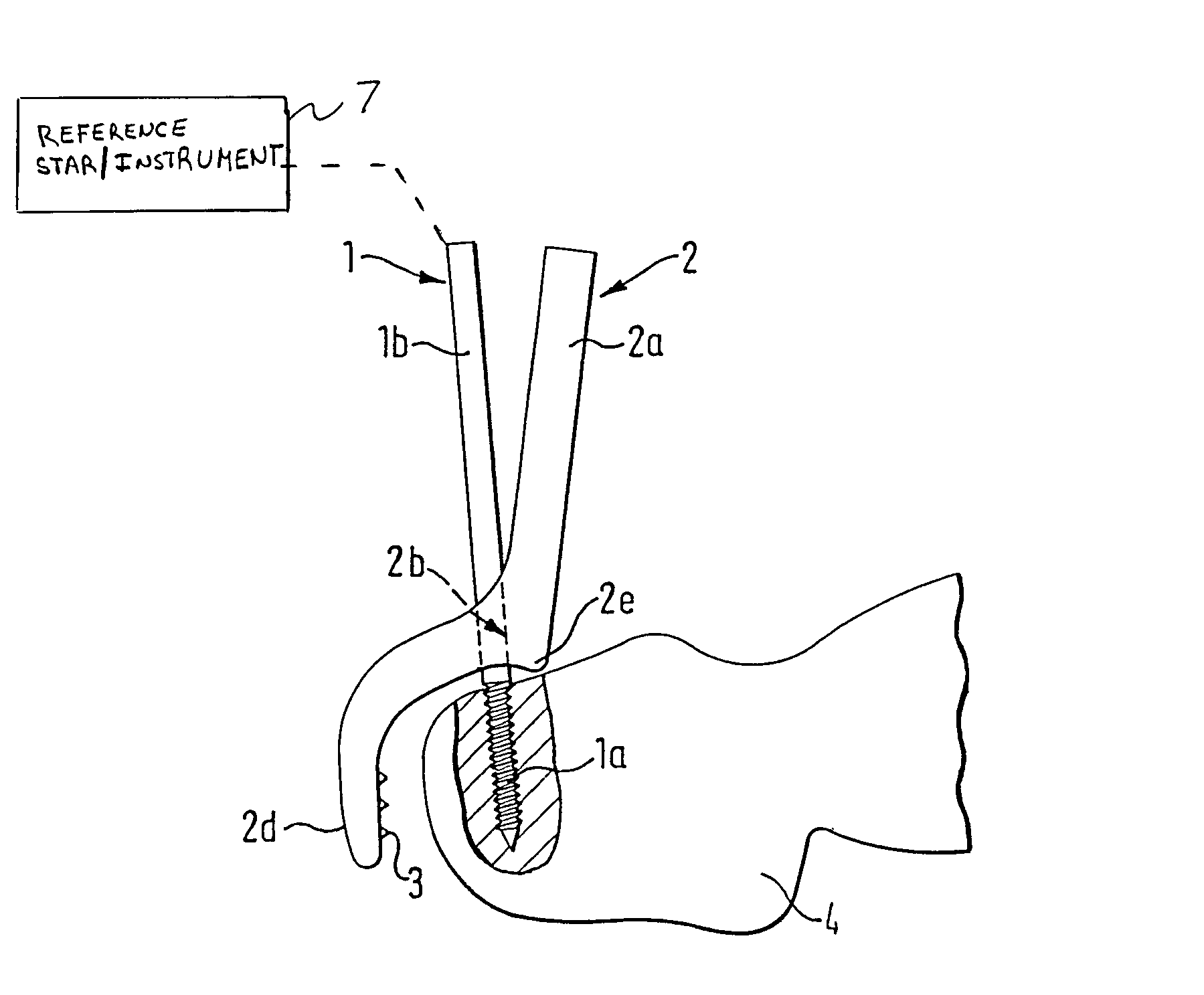 Device for fixing a reference element