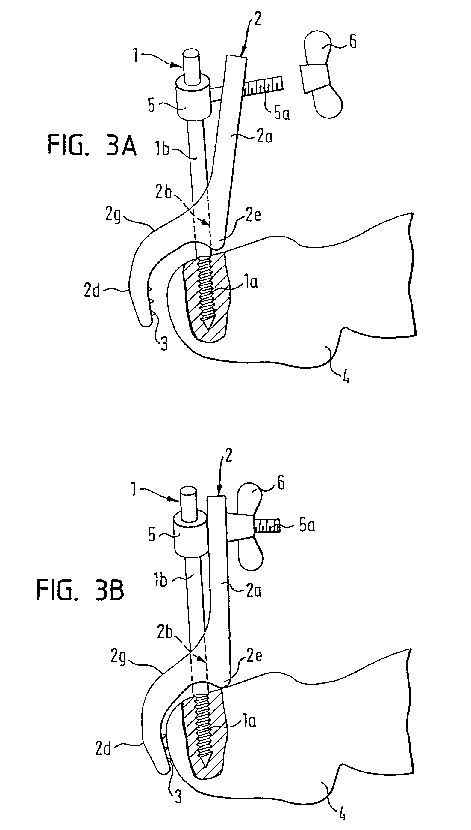 Device for fixing a reference element