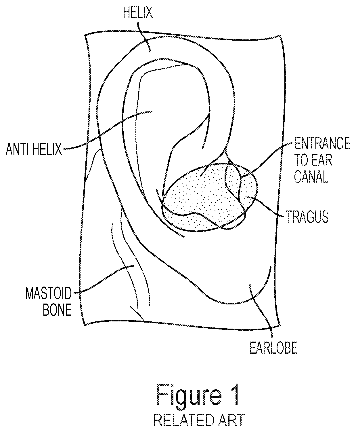 In-ear headphones with an ergonomic cushion and an ergonomic cushion thereof