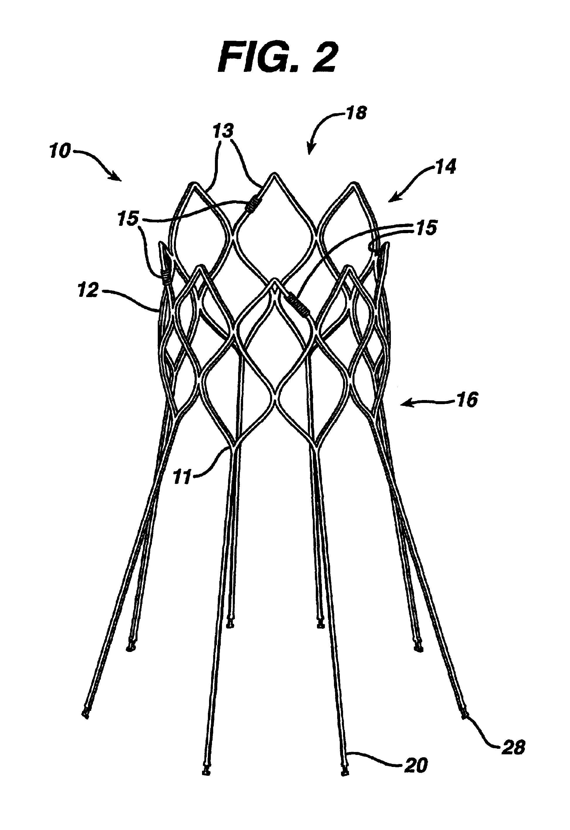 Supra-renal prosthesis and renal artery bypass