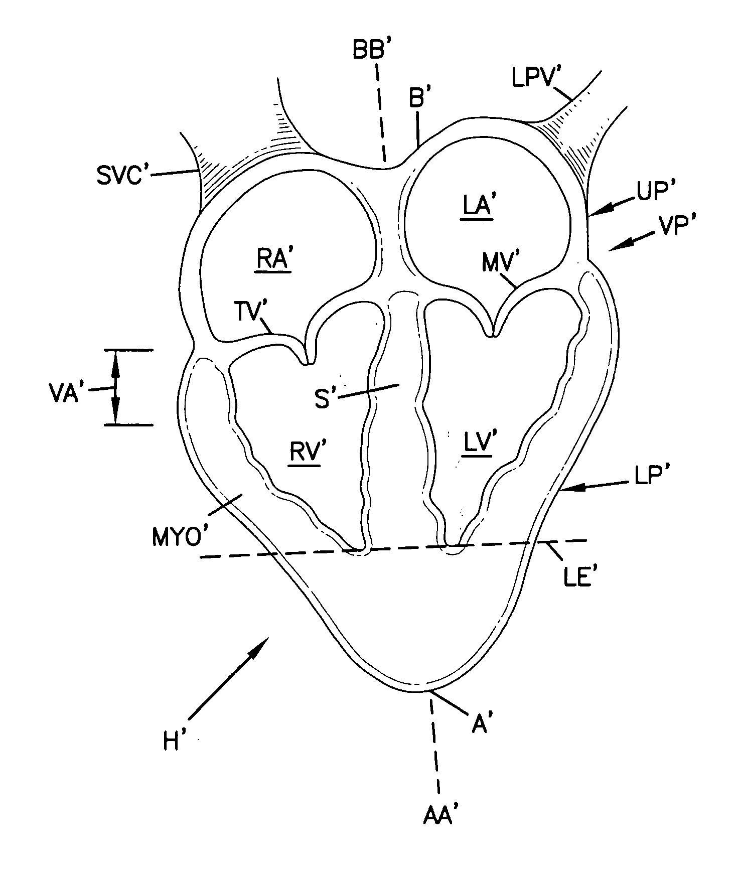 Cardiac support device