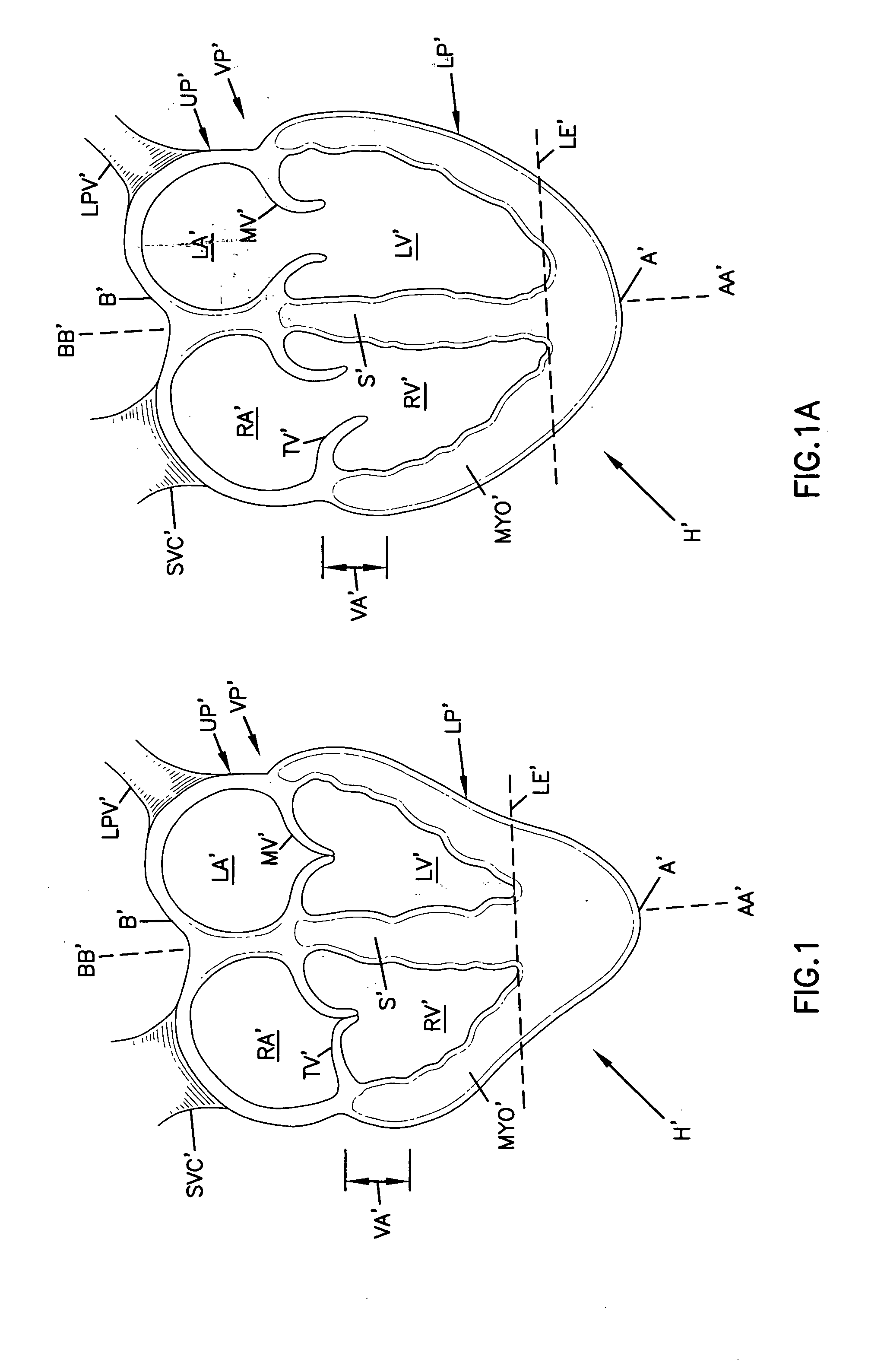 Cardiac support device