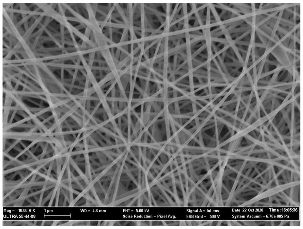 Chitosan-based nanofiber wound dressing with adhesiveness and antibacterial property and preparation method of chitosan-based nanofiber wound dressing