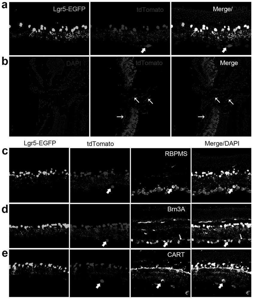 Method for regenerating functional retinal ganglion cells by using transcription factor