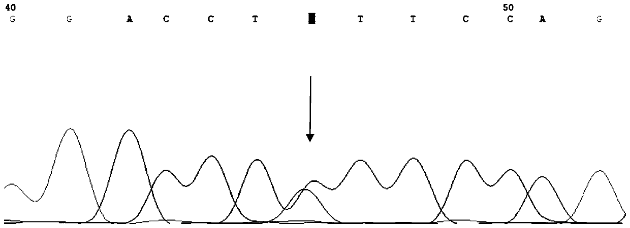 Kit for mutation detection of pathogenic gene SLC26A4 of vestibular aqueduct enlargement/Pendred syndrome