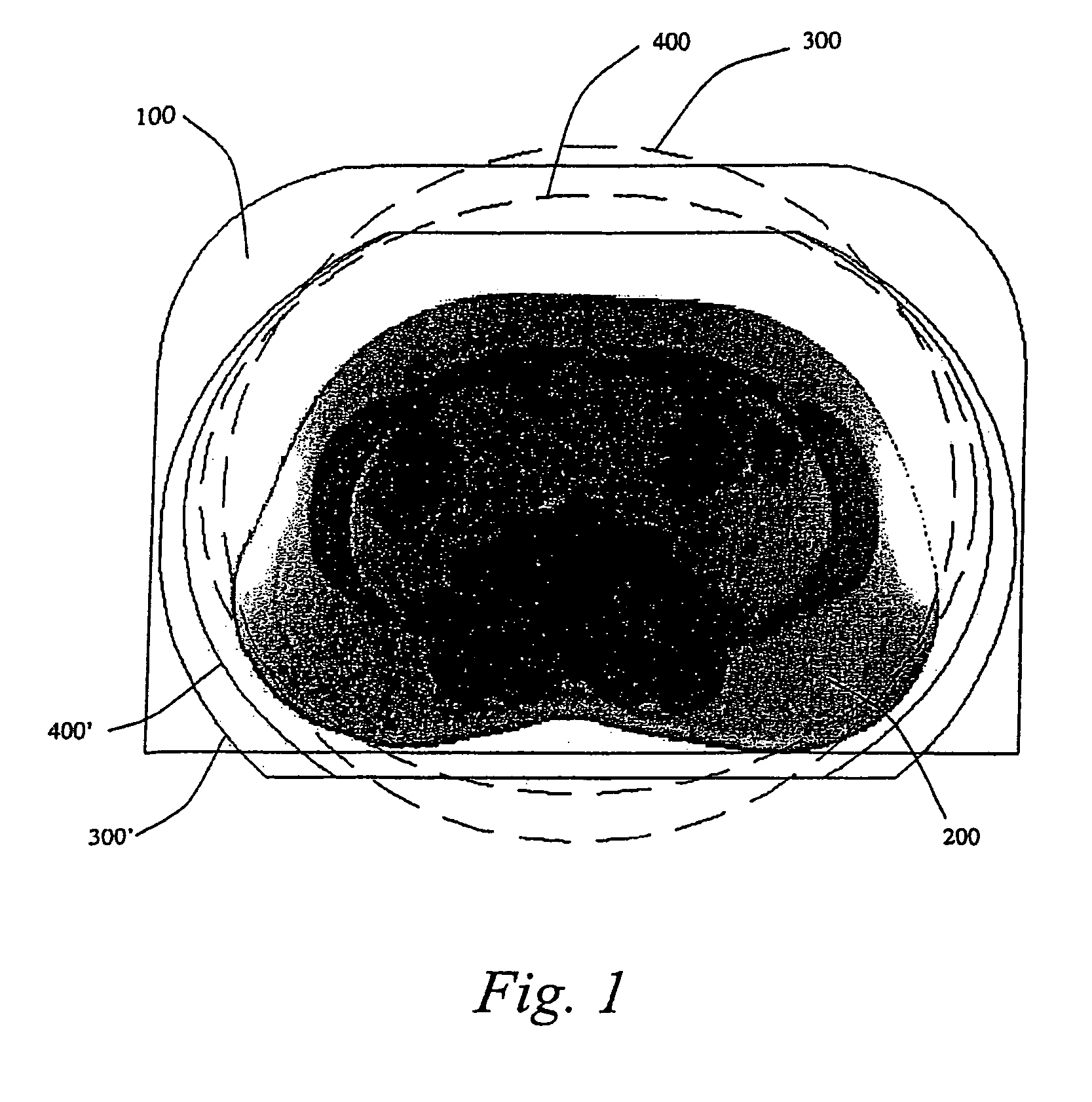 Shimmed magnetic resonance imaging apparatus and shimming method therefor