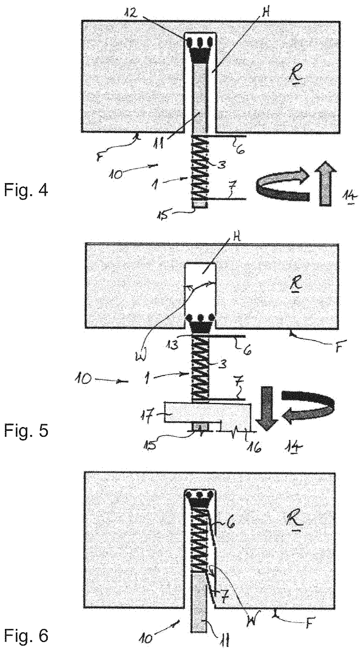 Retainer device for a rock anchor, rock anchor system and associated installation method