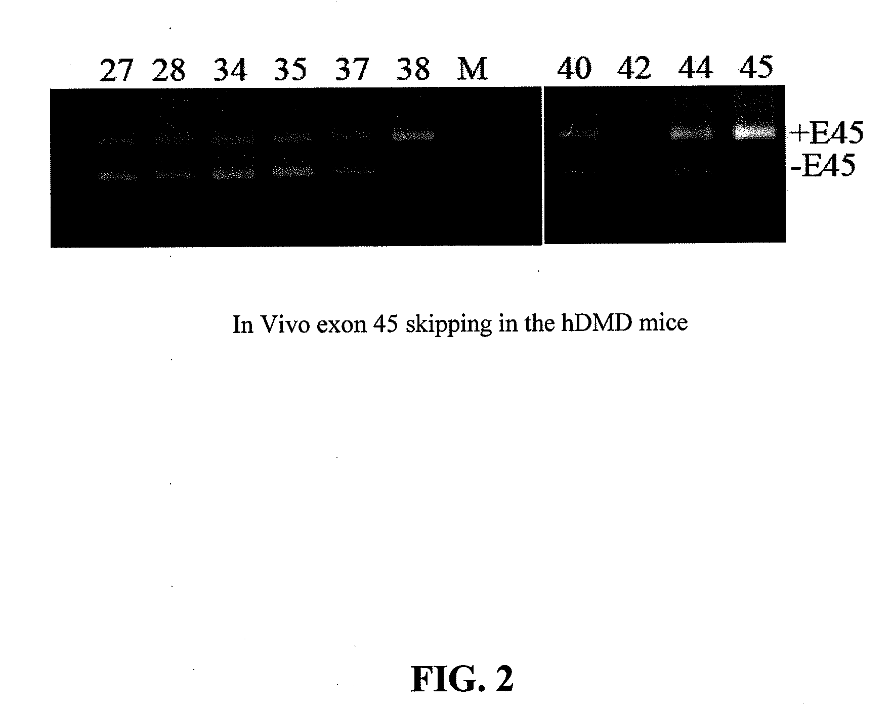 Antisense Oligonucleotides