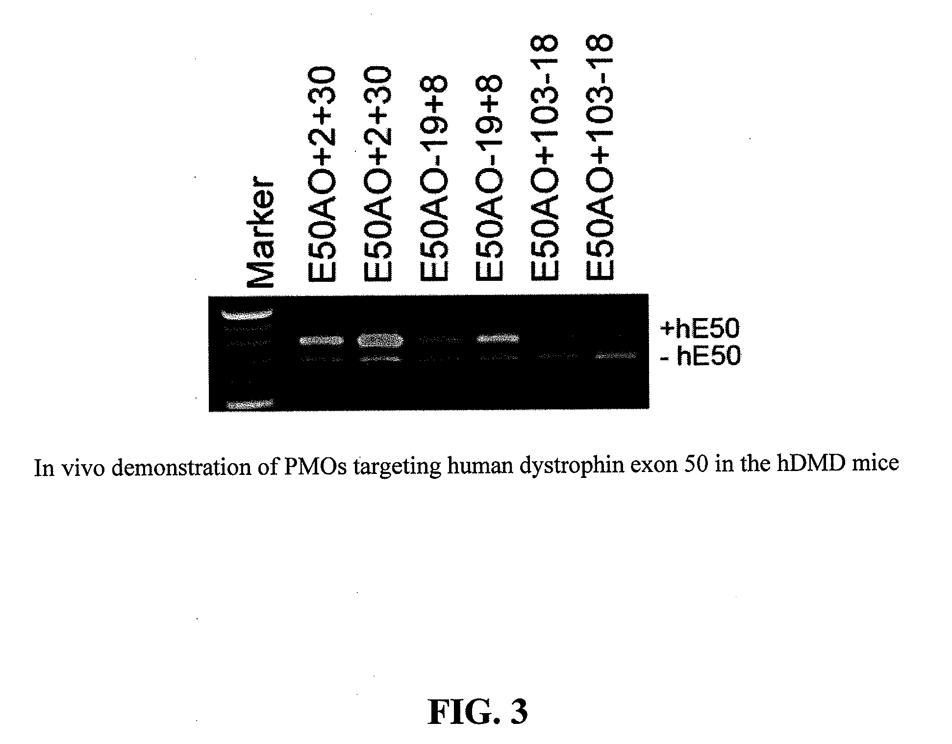 Antisense Oligonucleotides