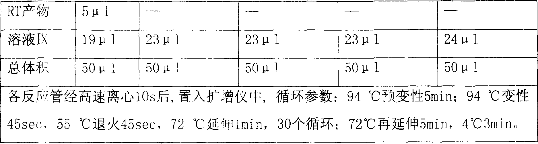 Multiple RT-PCR identification and detection reagent for animal vesicular disease and preparation method and use thereof