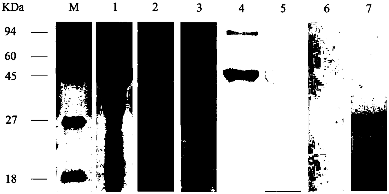 Application of scabies protein tyrosine kinase and kit for diagnosing scabies