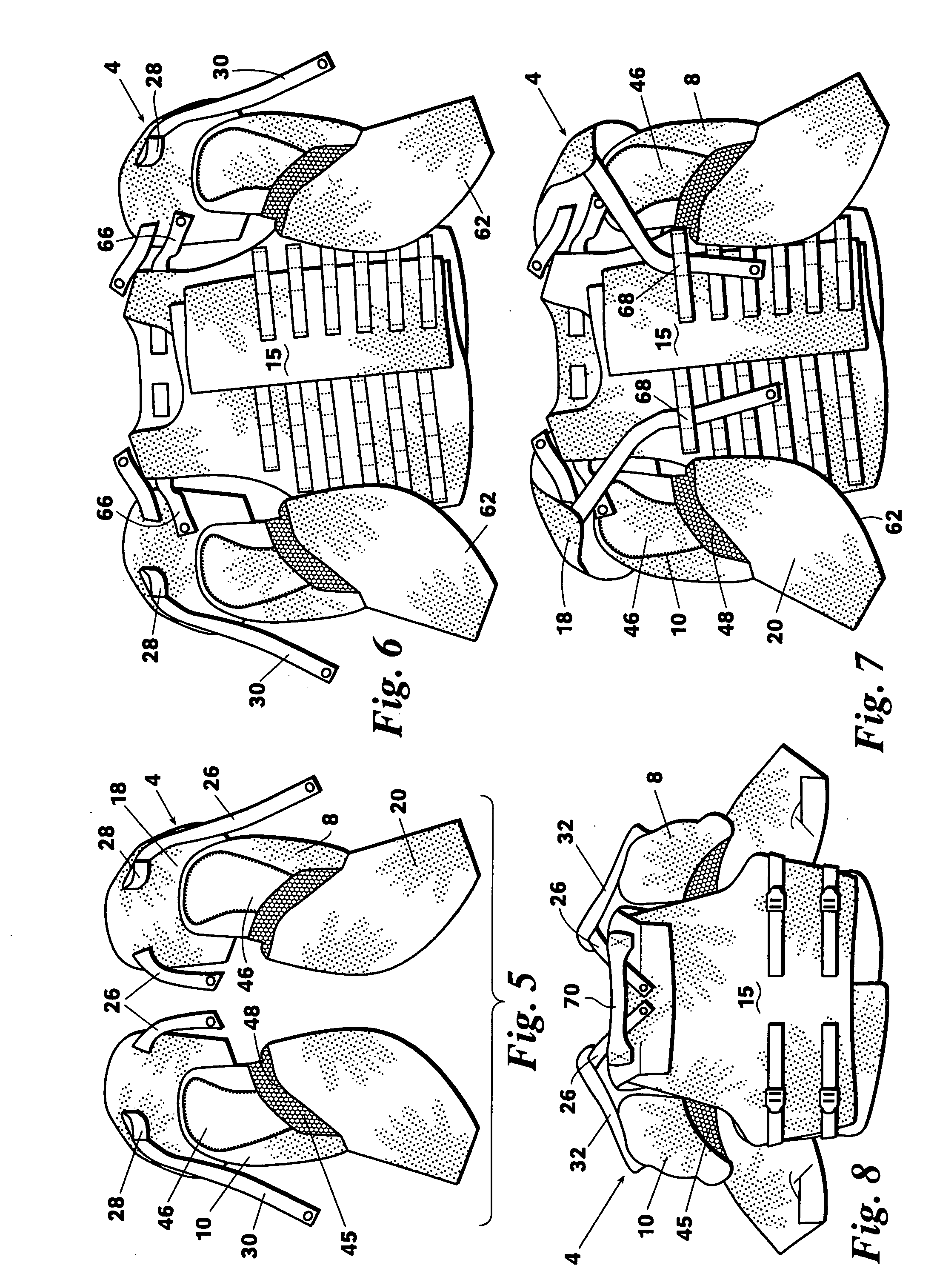 Extremity armor