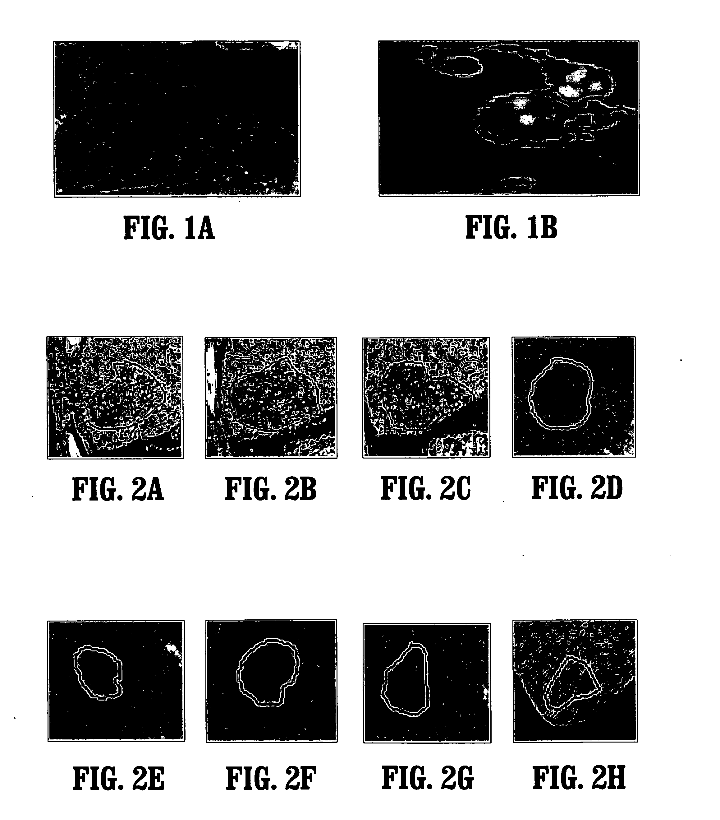 System and Method For Shape Regulation of Segmented Target Objects