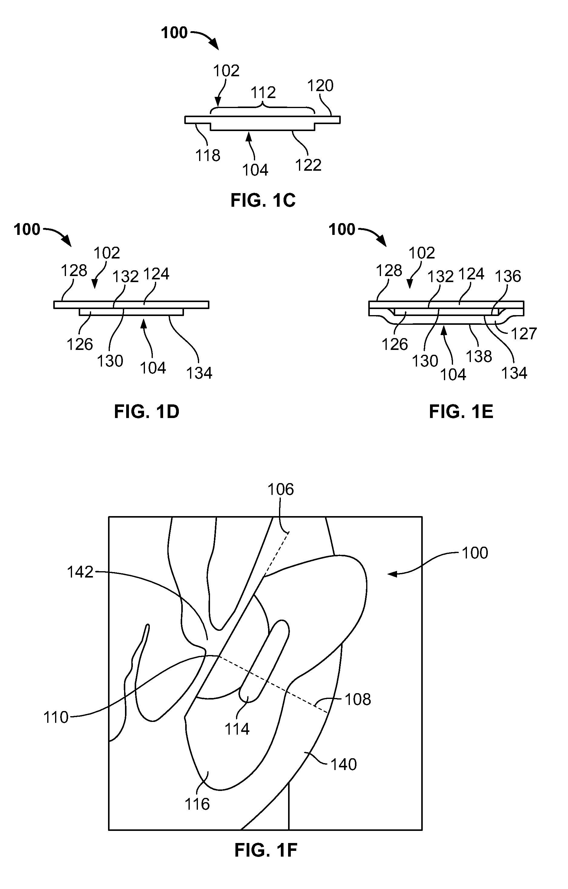 Devices and methods for treating accidental bowel leakage