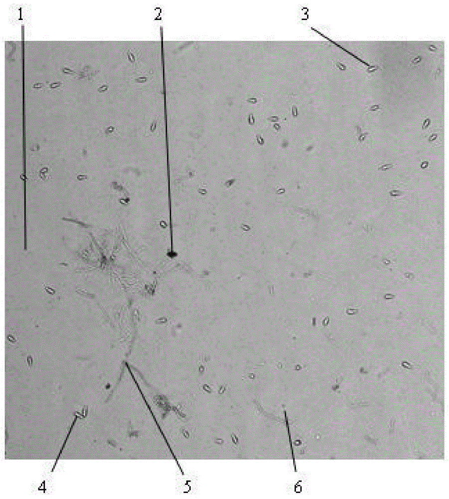 Method for detecting magnaporthe grisea spore based on microscopic image analysis