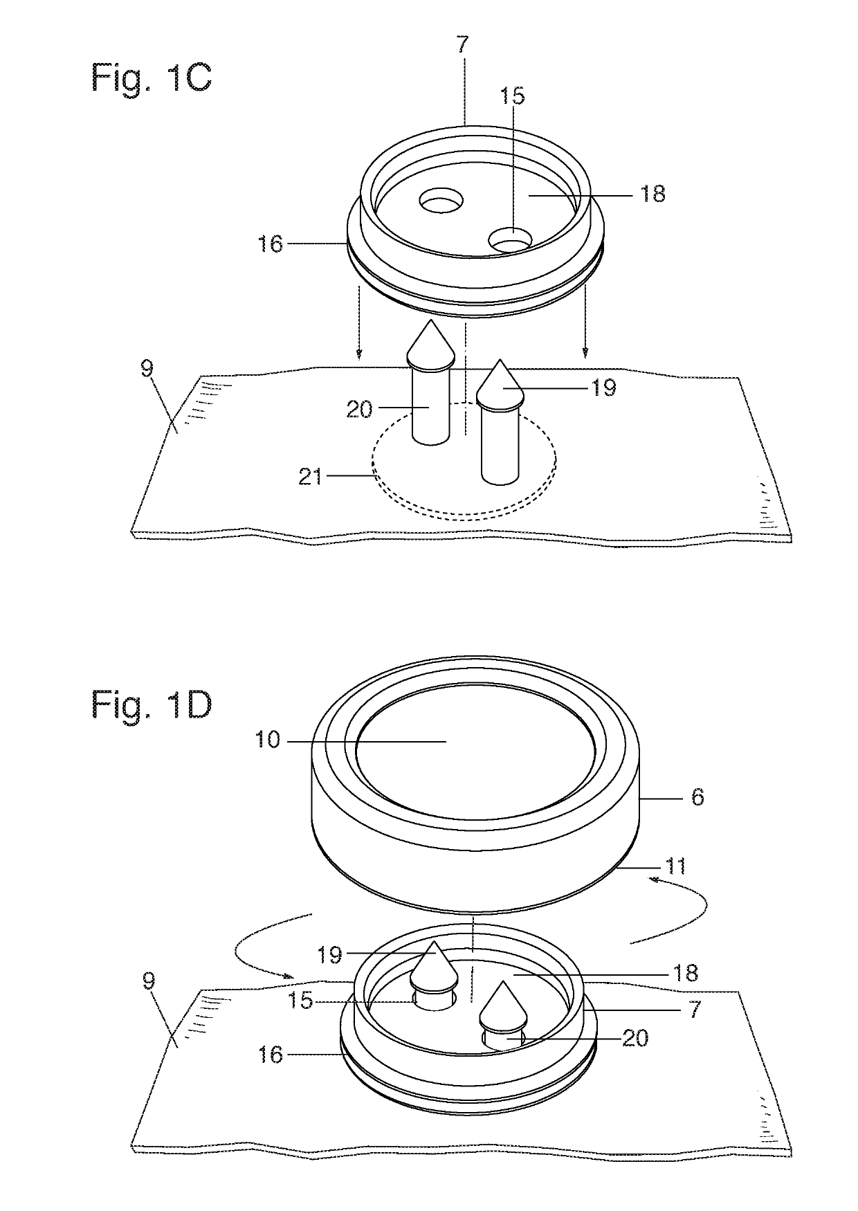 Interchangeable button system technology