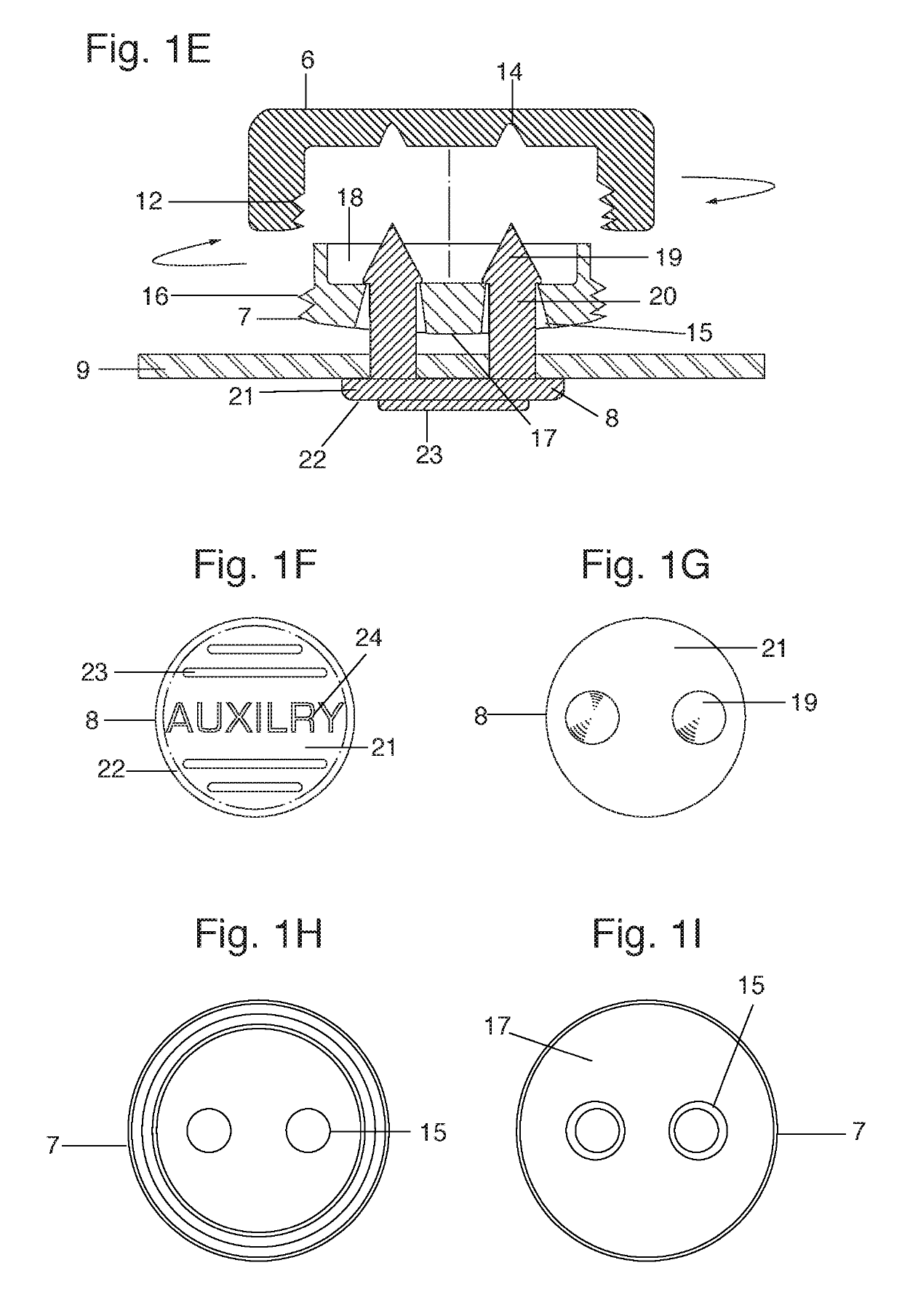 Interchangeable button system technology