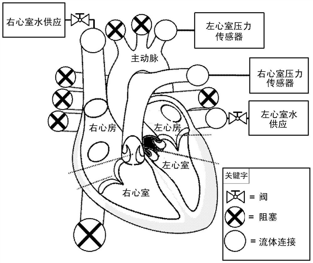 heart assist device