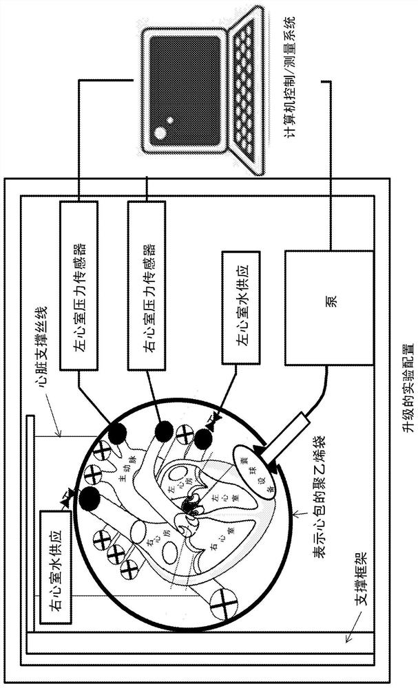 heart assist device