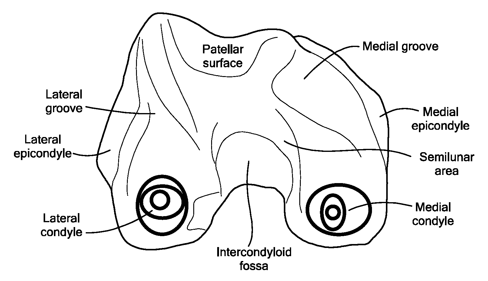 Patient Selectable Joint Arthroplasty Devices and Surgical Tools