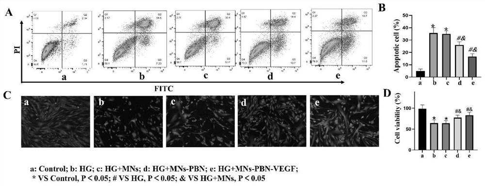 Oxidase-loaded microneedle for promoting wound healing of diabetic patient and preparation method of oxidase-loaded microneedle