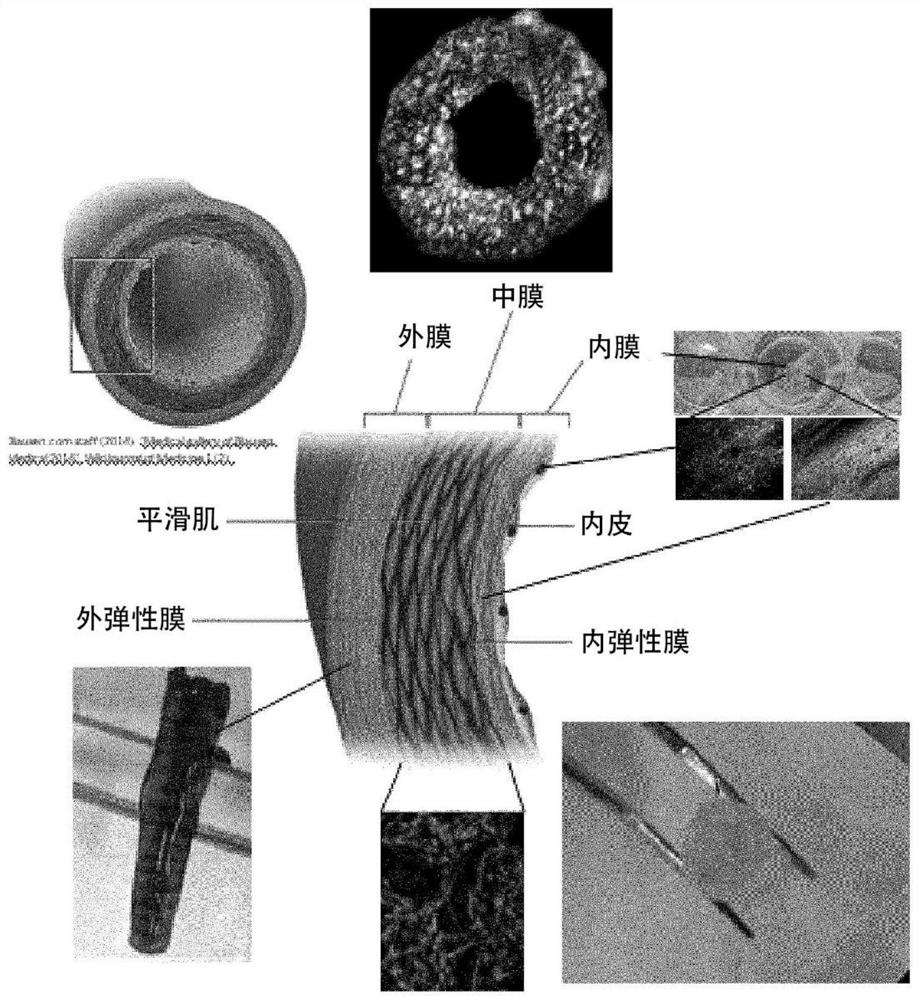 Composite biomaterial