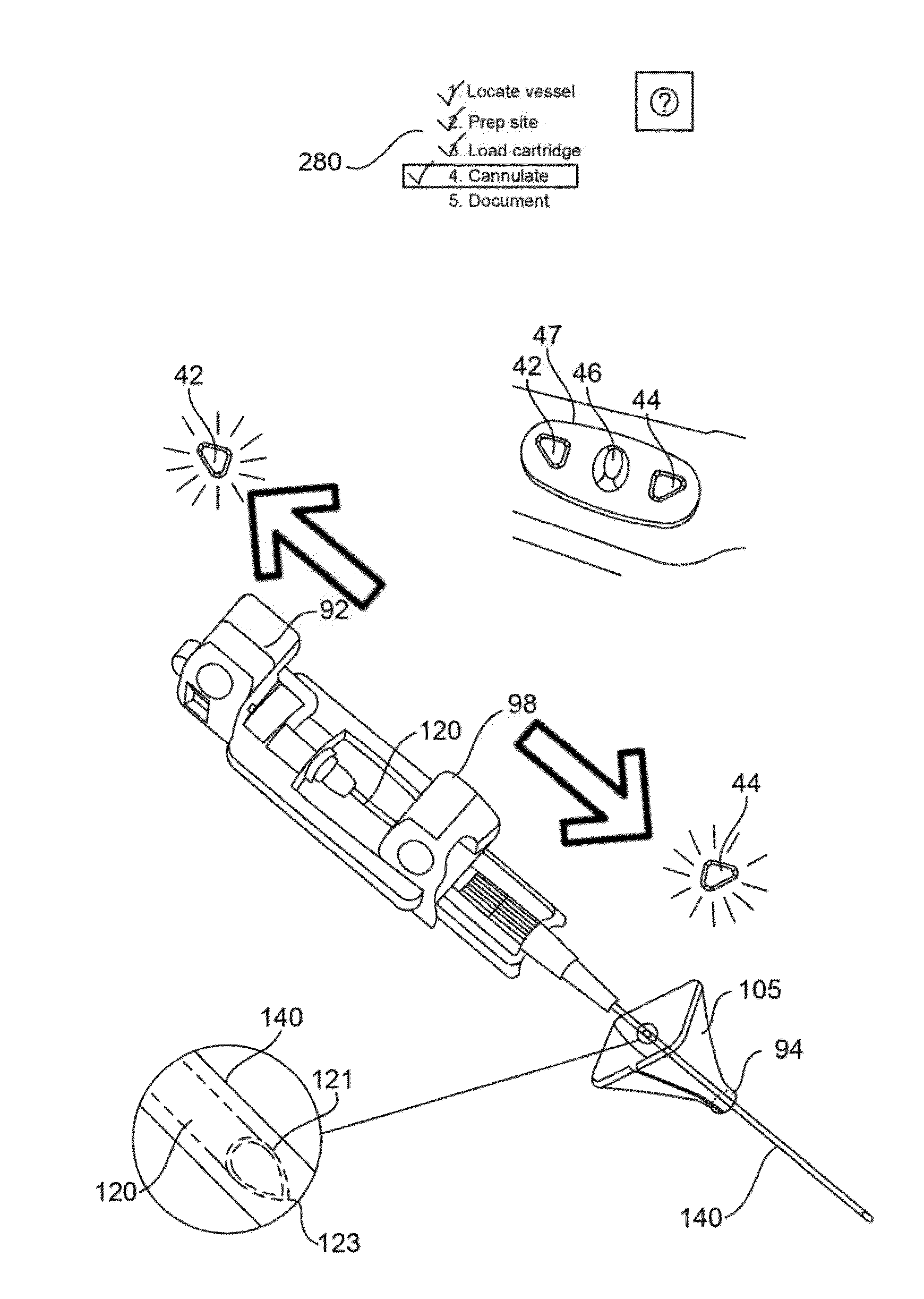 Cartridge for a blood vessel access system and device