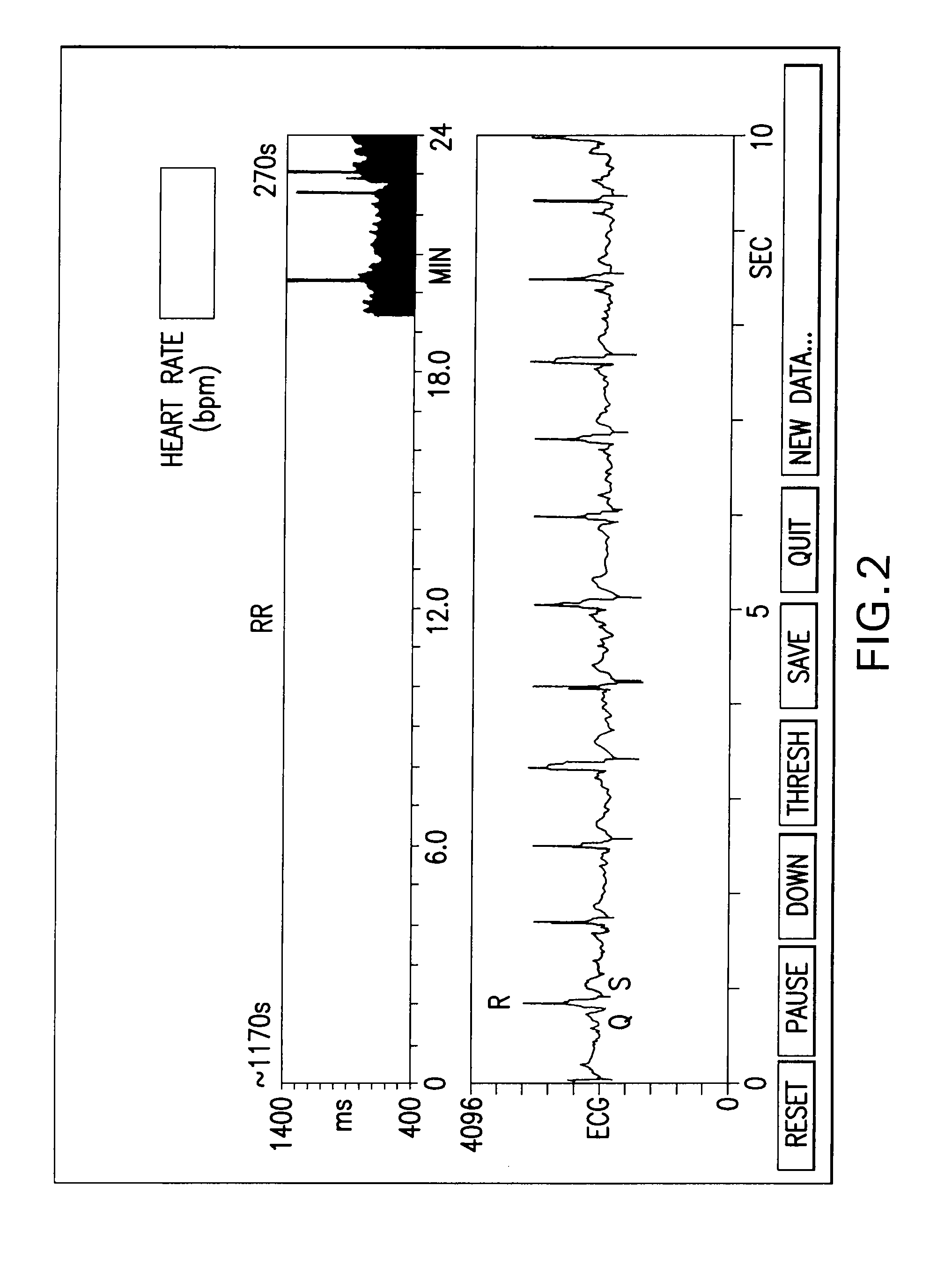 Method and Apparatus For Affecting The Autonomic Nervous System