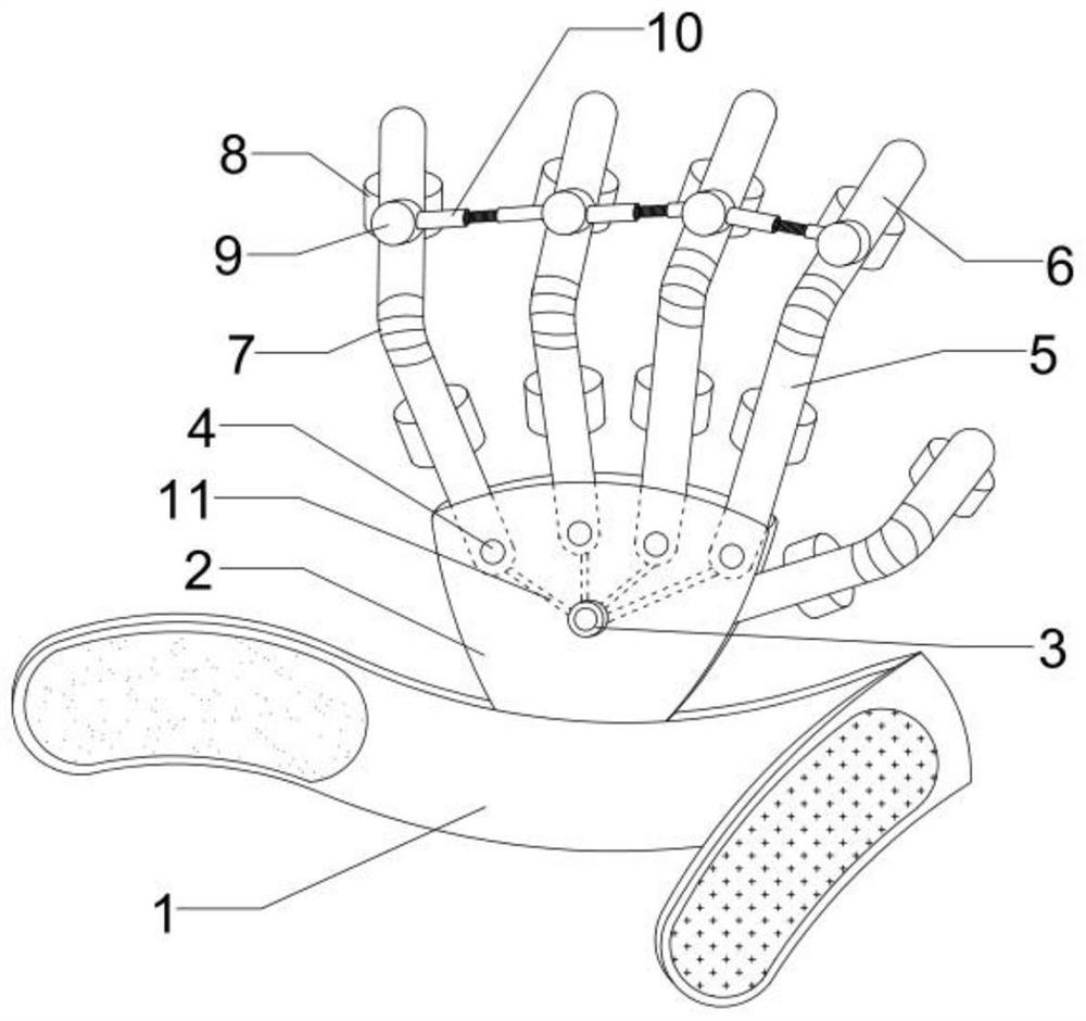 Inter-finger skin burn rehabilitation limiter