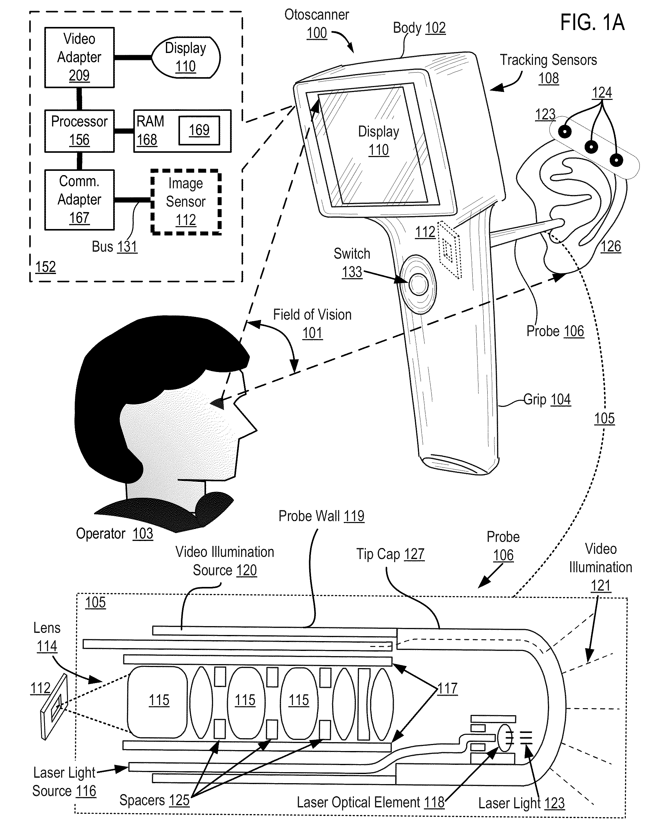 Otoscanning With 3D Modeling