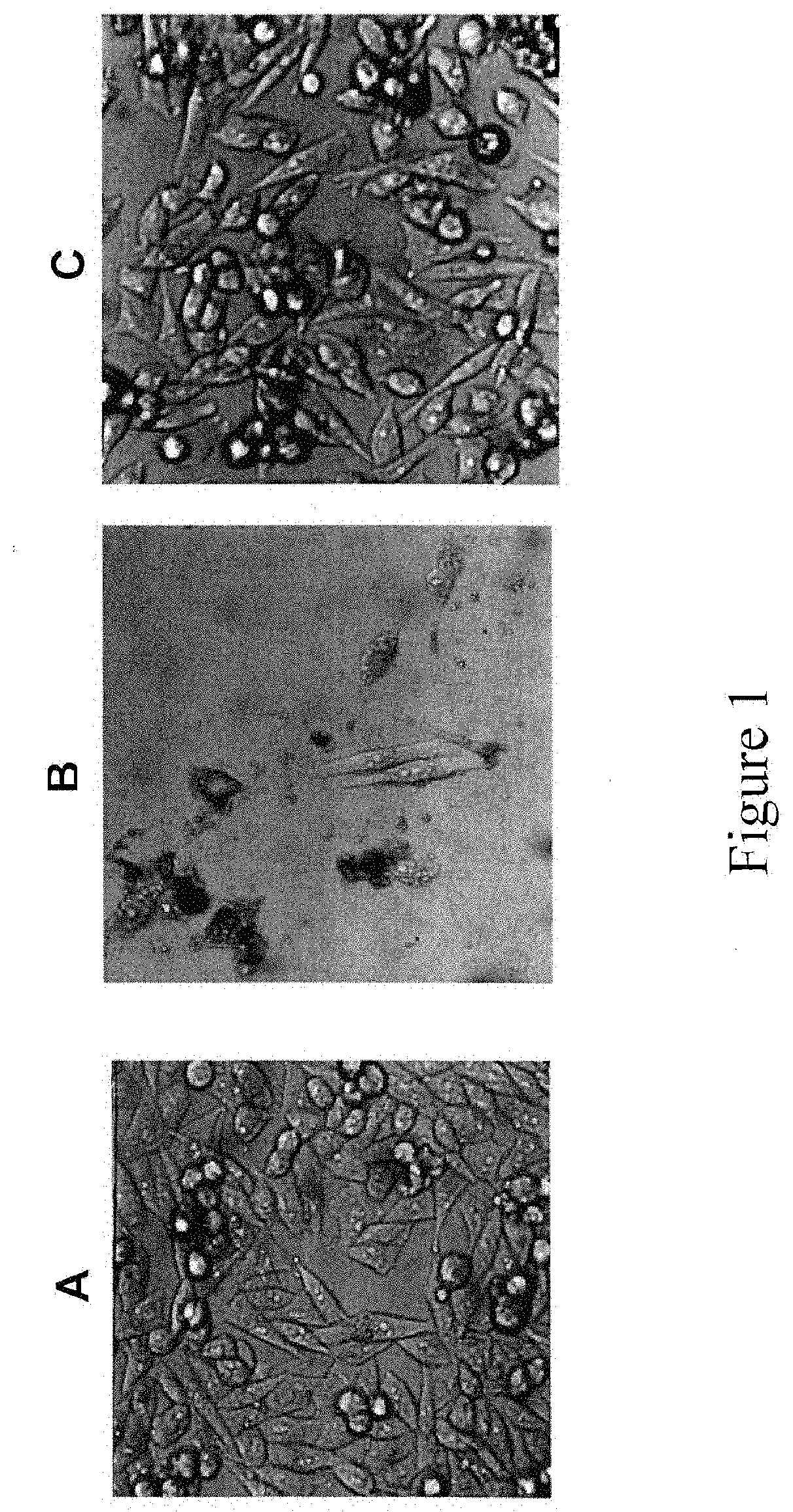 Hdm-2 targeting compositions cause tumor cell necrosis rather than apoptosis of cancer cells