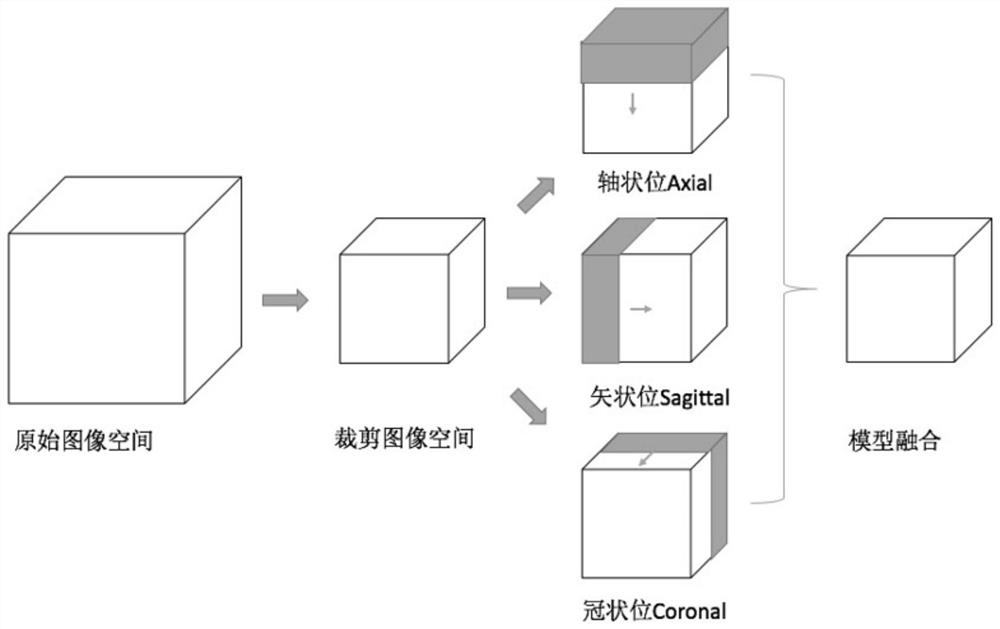 Coronary vessel extraction method and device based on multi-view model fusion