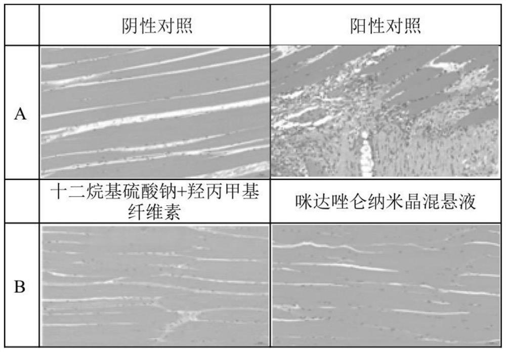 Midazolam nanocrystal suspension as well as preparation method and application thereof