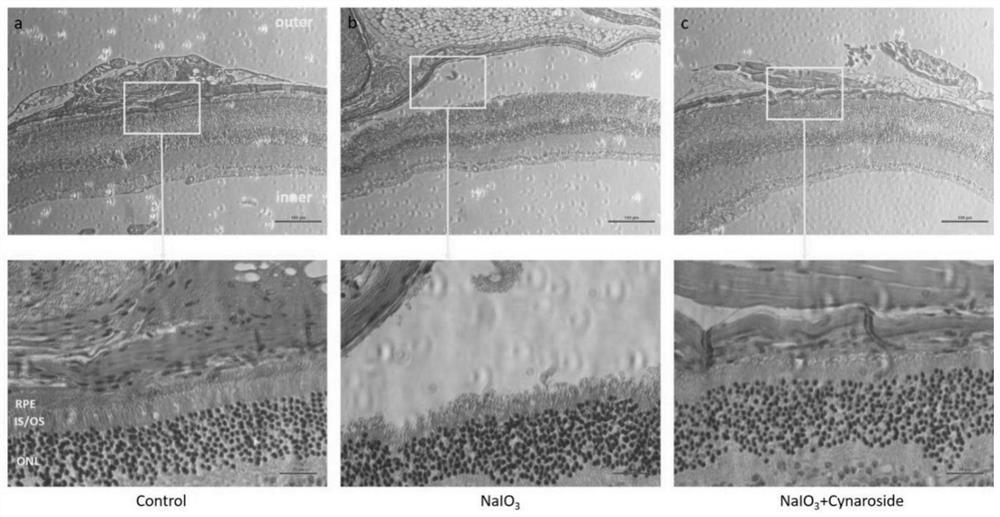 Application of luteolin-7-O-glucoside to preparation of medicine for treating diseases caused by retinal degeneration