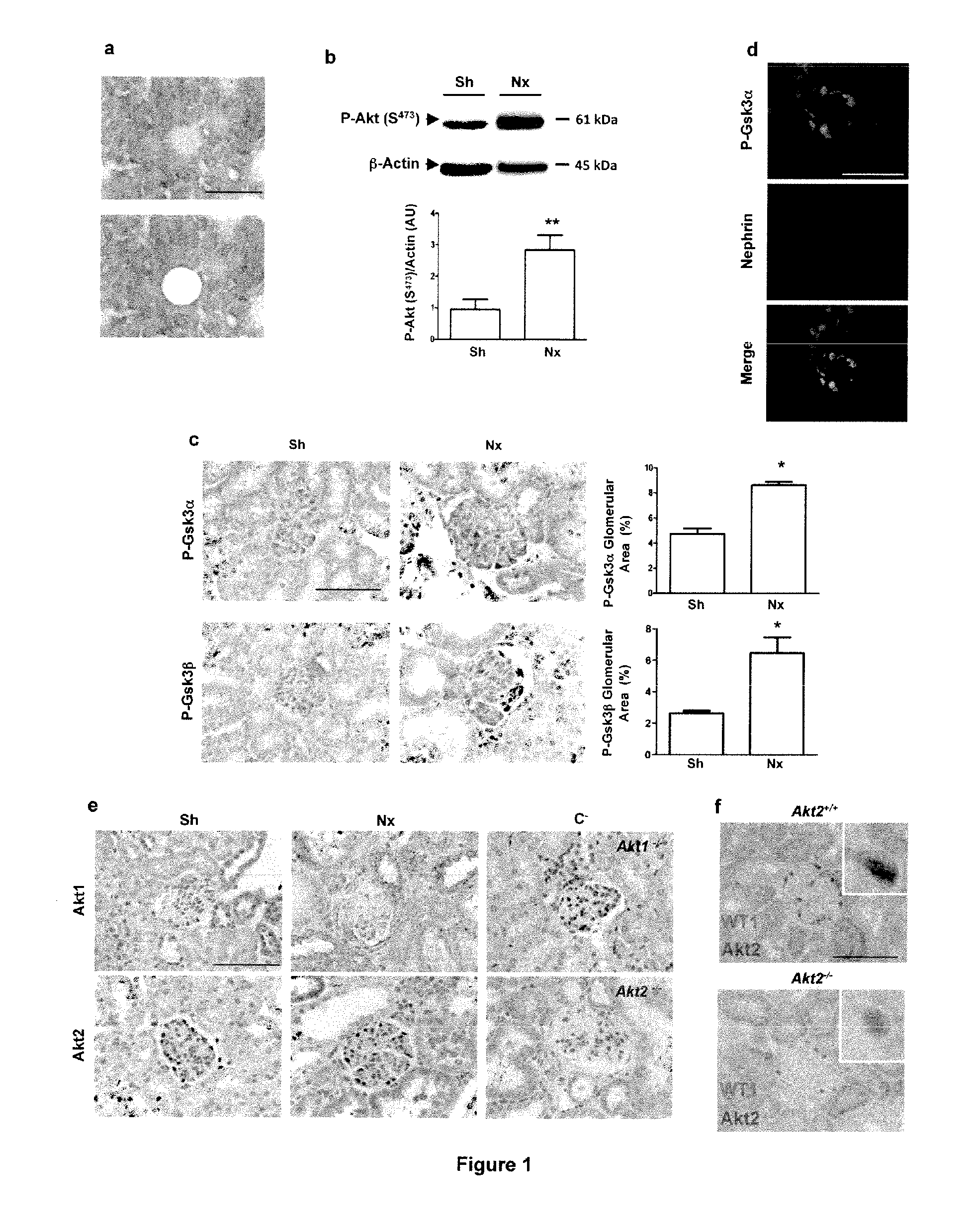 Biomarkers of renal disorders