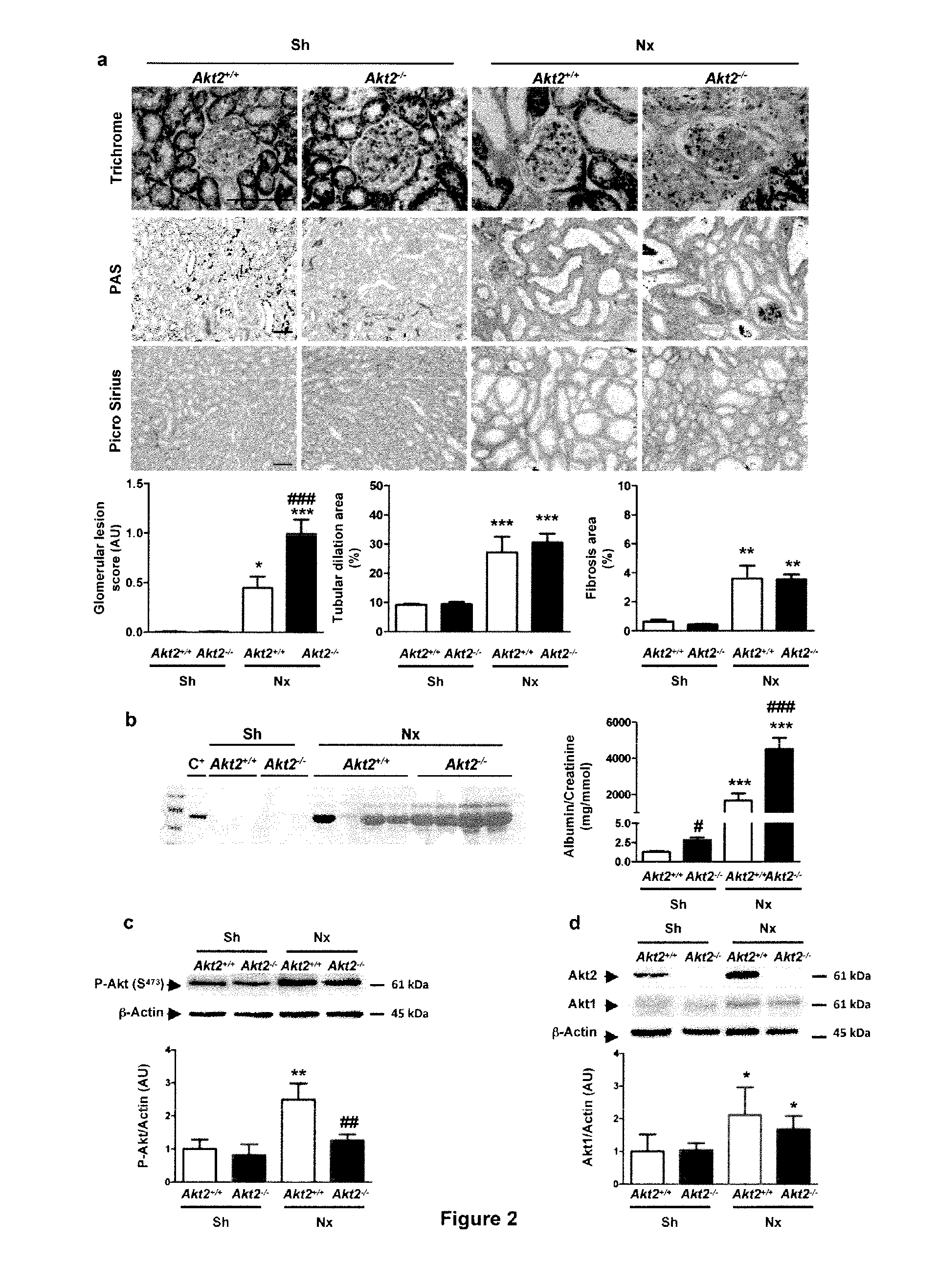 Biomarkers of renal disorders