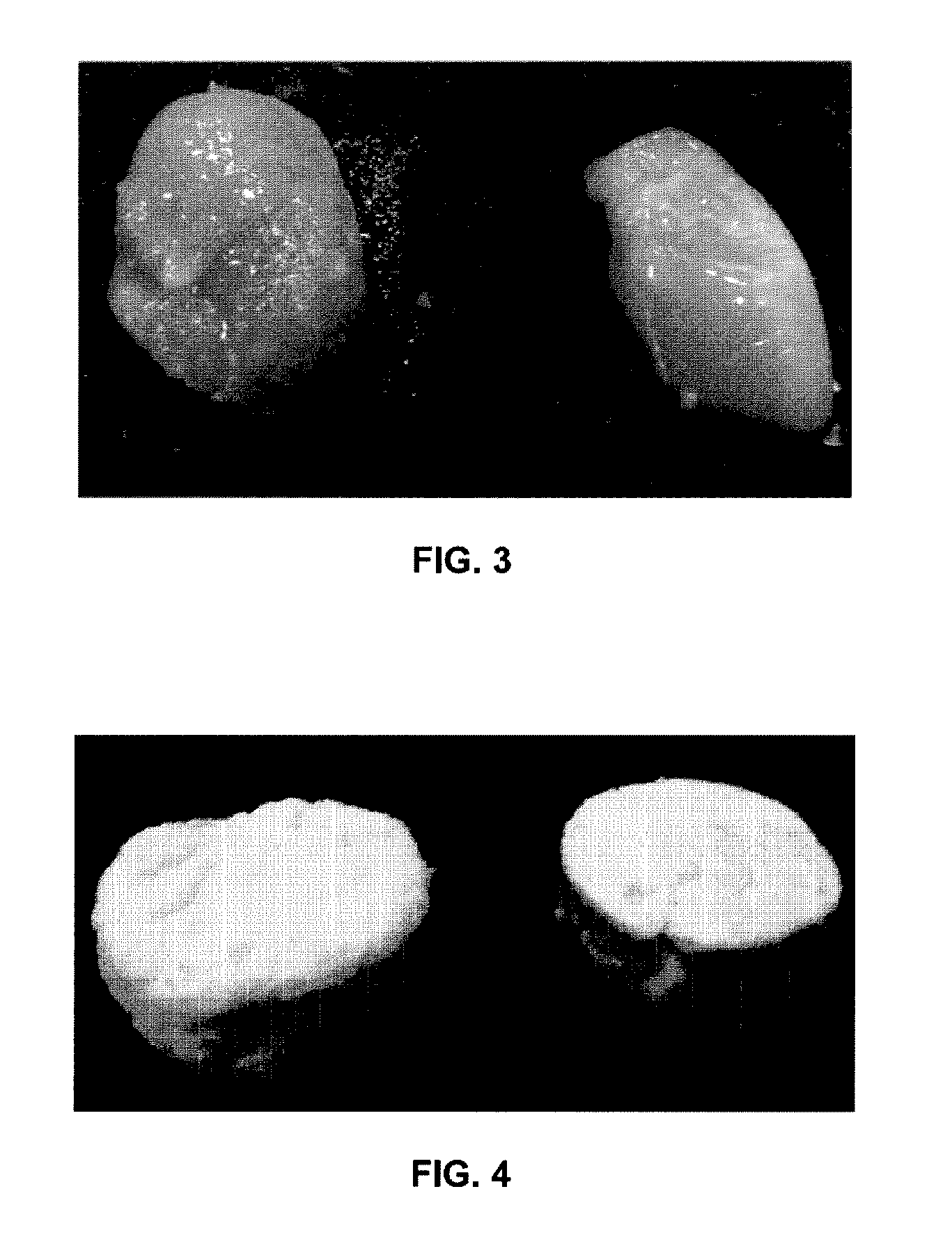 Healthy food compositions having gel or foam textures and comprising hydrolyzed egg products